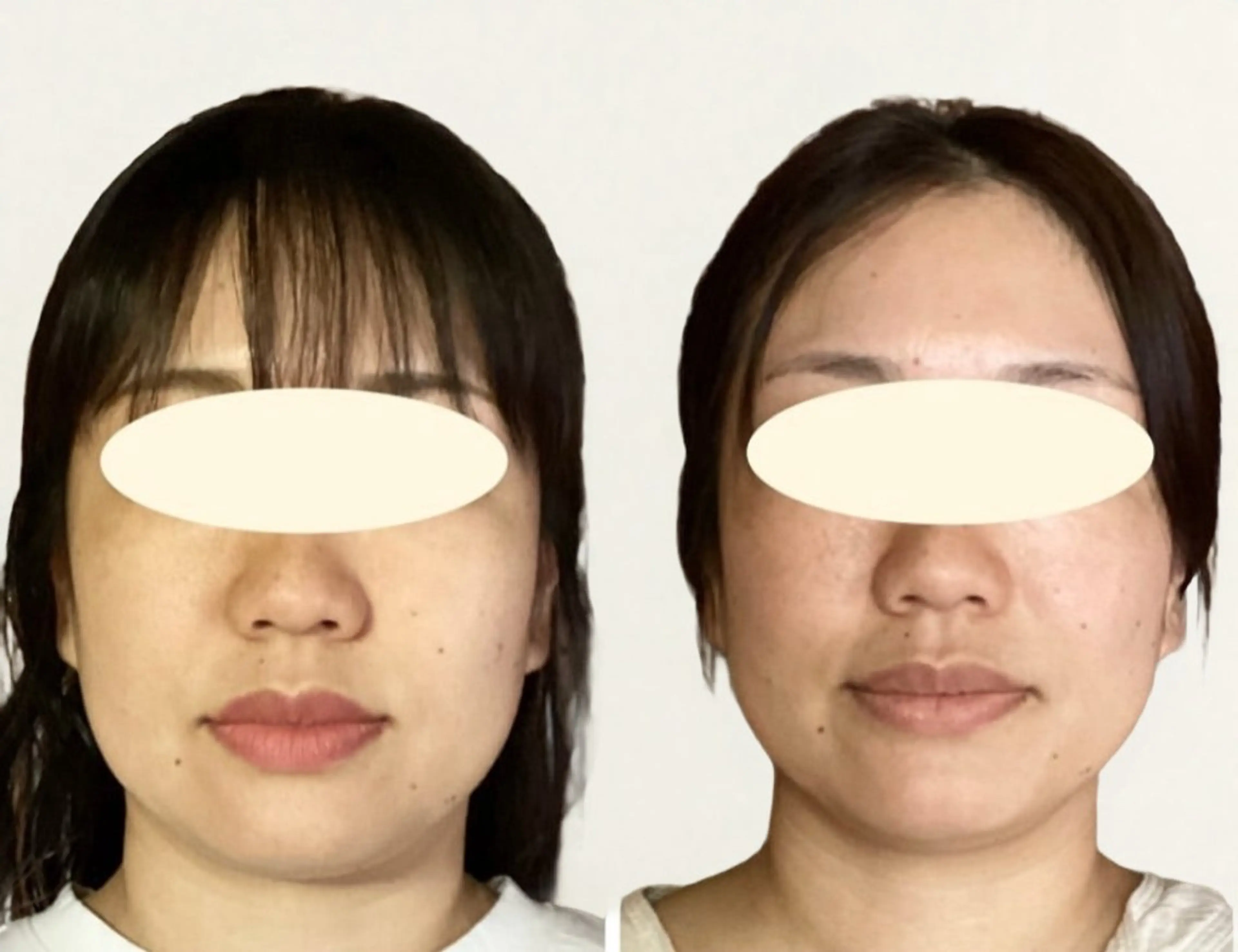 エステ リラク ルコナビューティ所属・小顔・歪み専門 井元 朋子のエステ・リラクイメージ