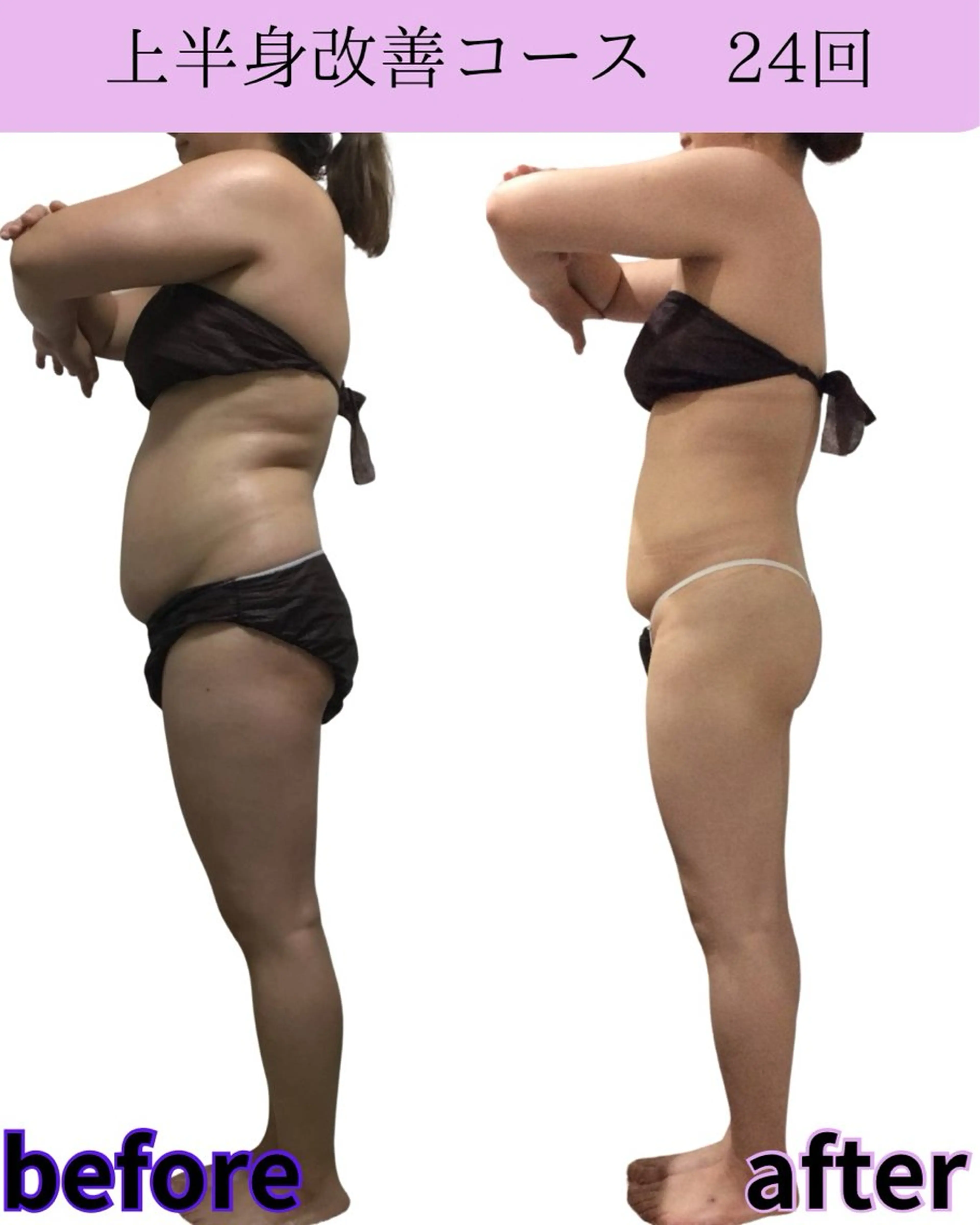 🔥3月限定🔥春の本気痩身！全身引き締めボディ120分コース¥25,000→¥13,000の写真