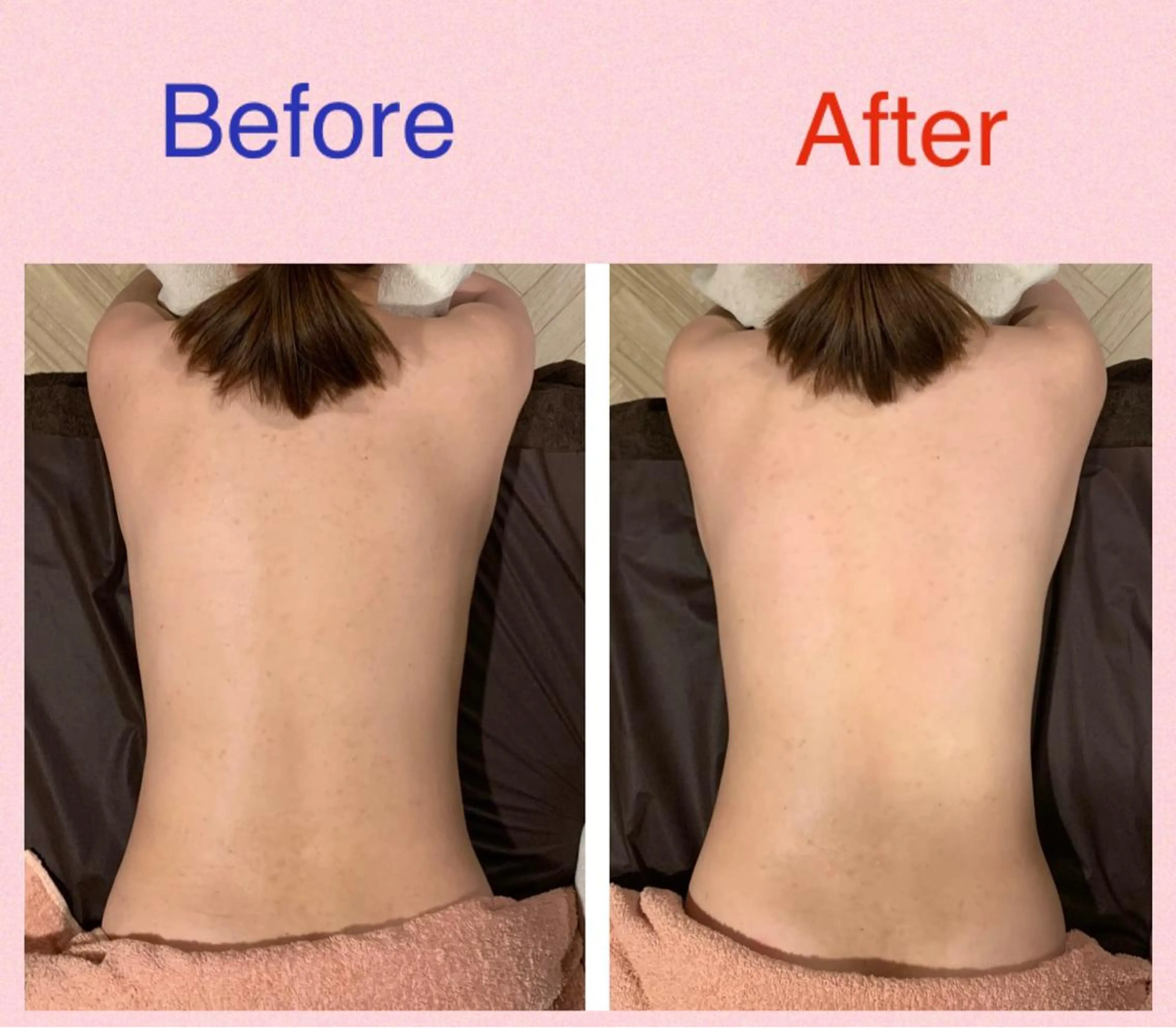 Rewhite -リホワイト-のエステ・リラクイメージ