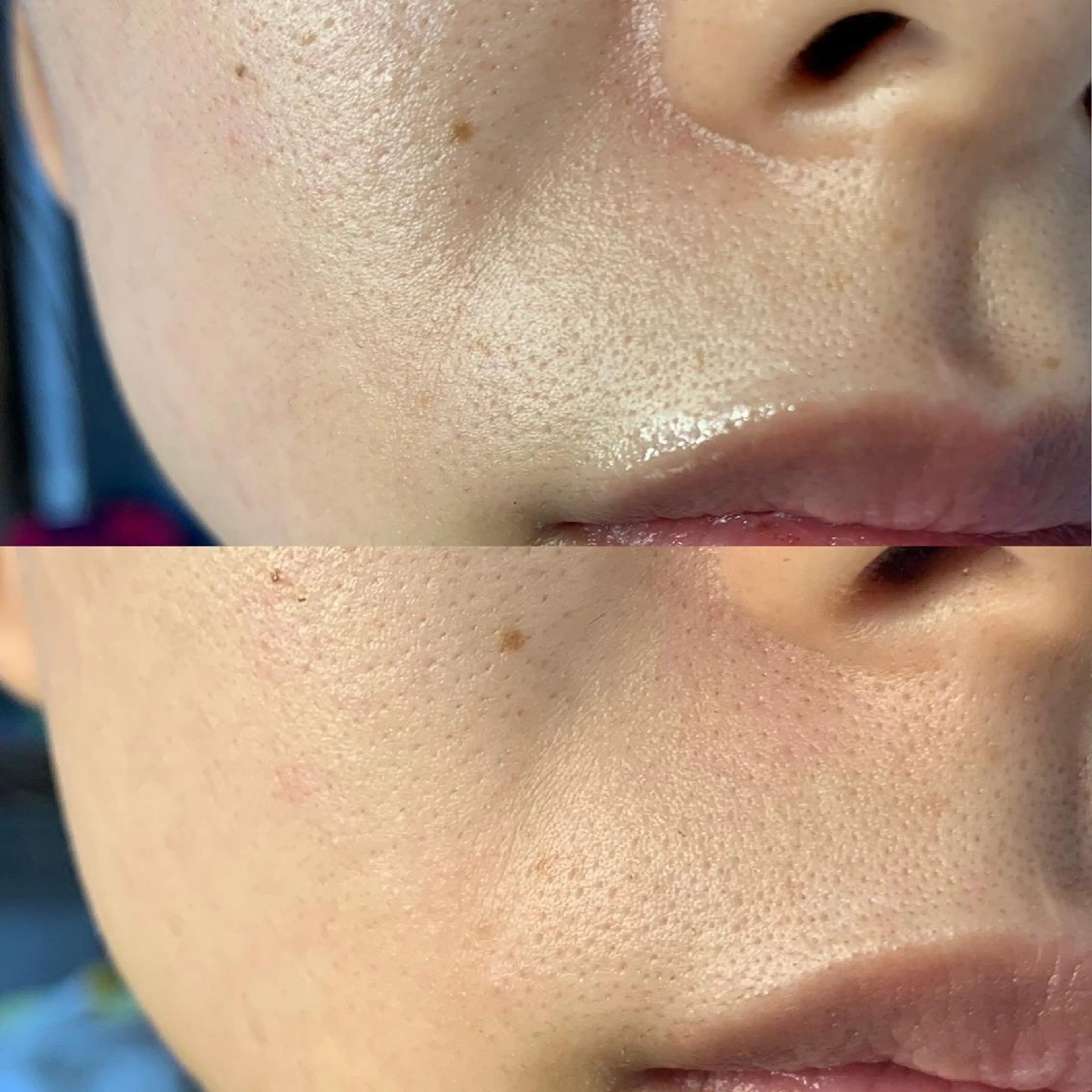 メンズ キッズ 脱毛SALON RaYNiCKのエステ・リラクイメージ