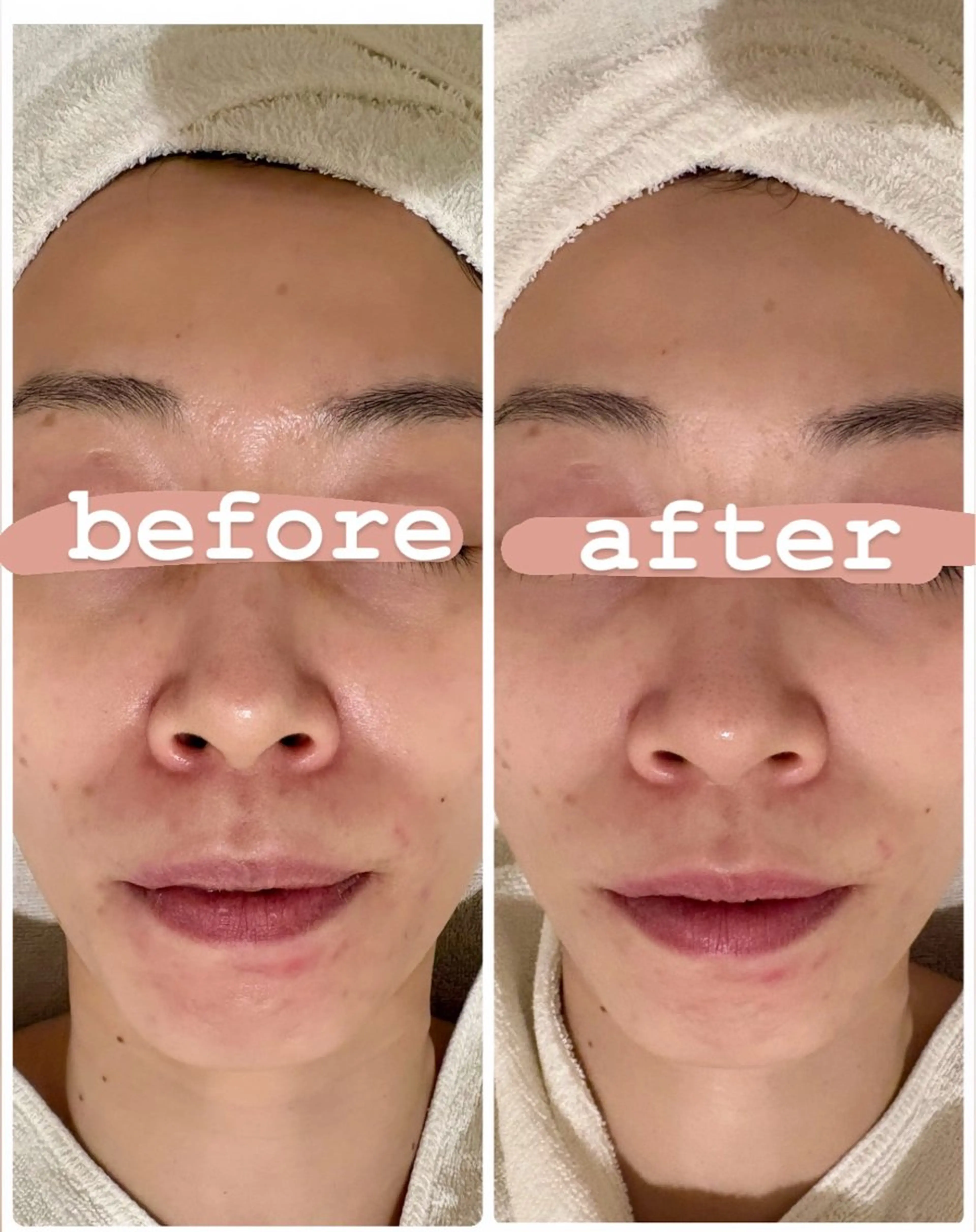 肌管理🌿毛穴改善 POLA堺東のエステ・リラクイメージ