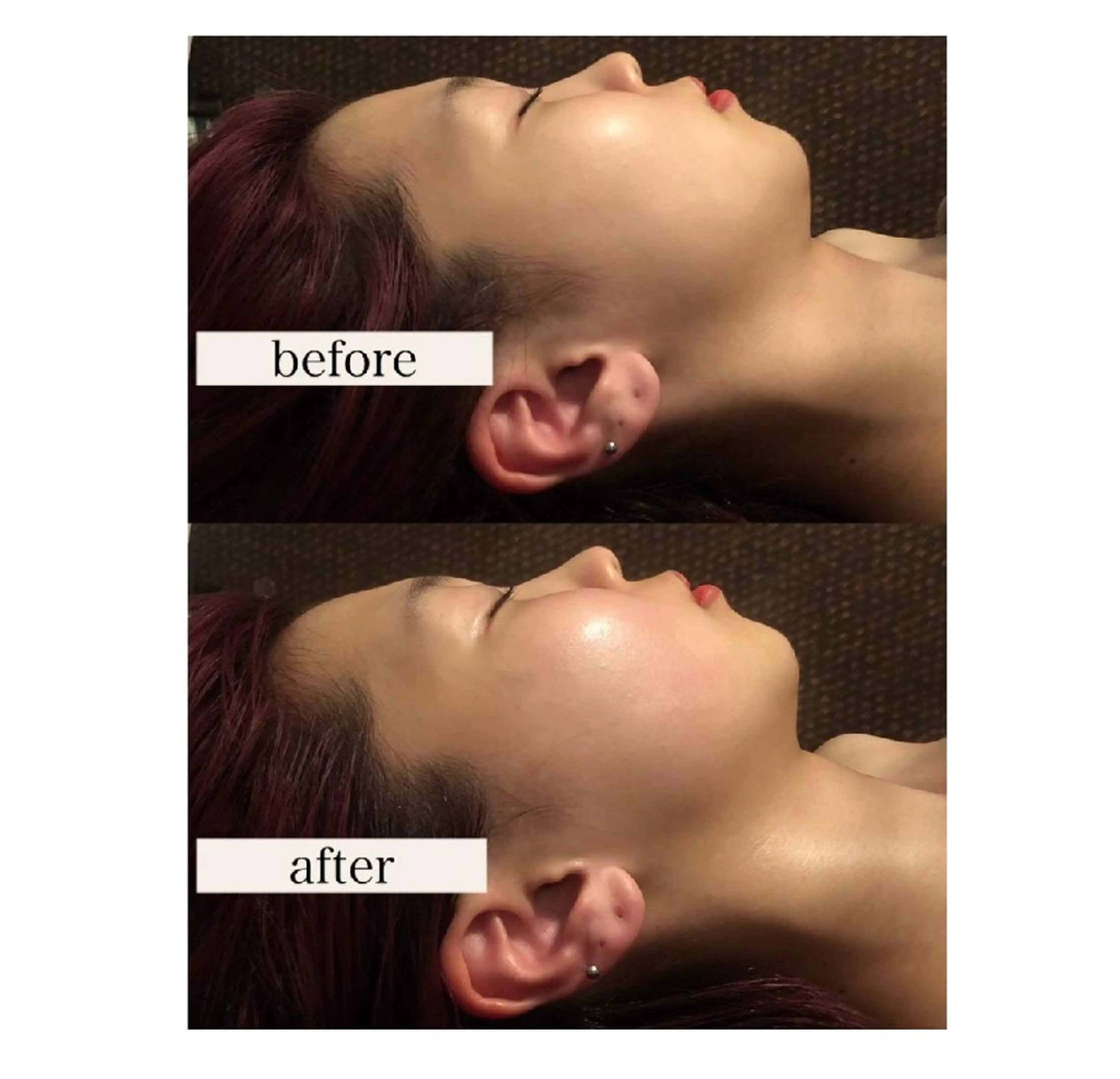 エステ リラク bianca 【菌活 温活 小顔】のエステ・リラクイメージ