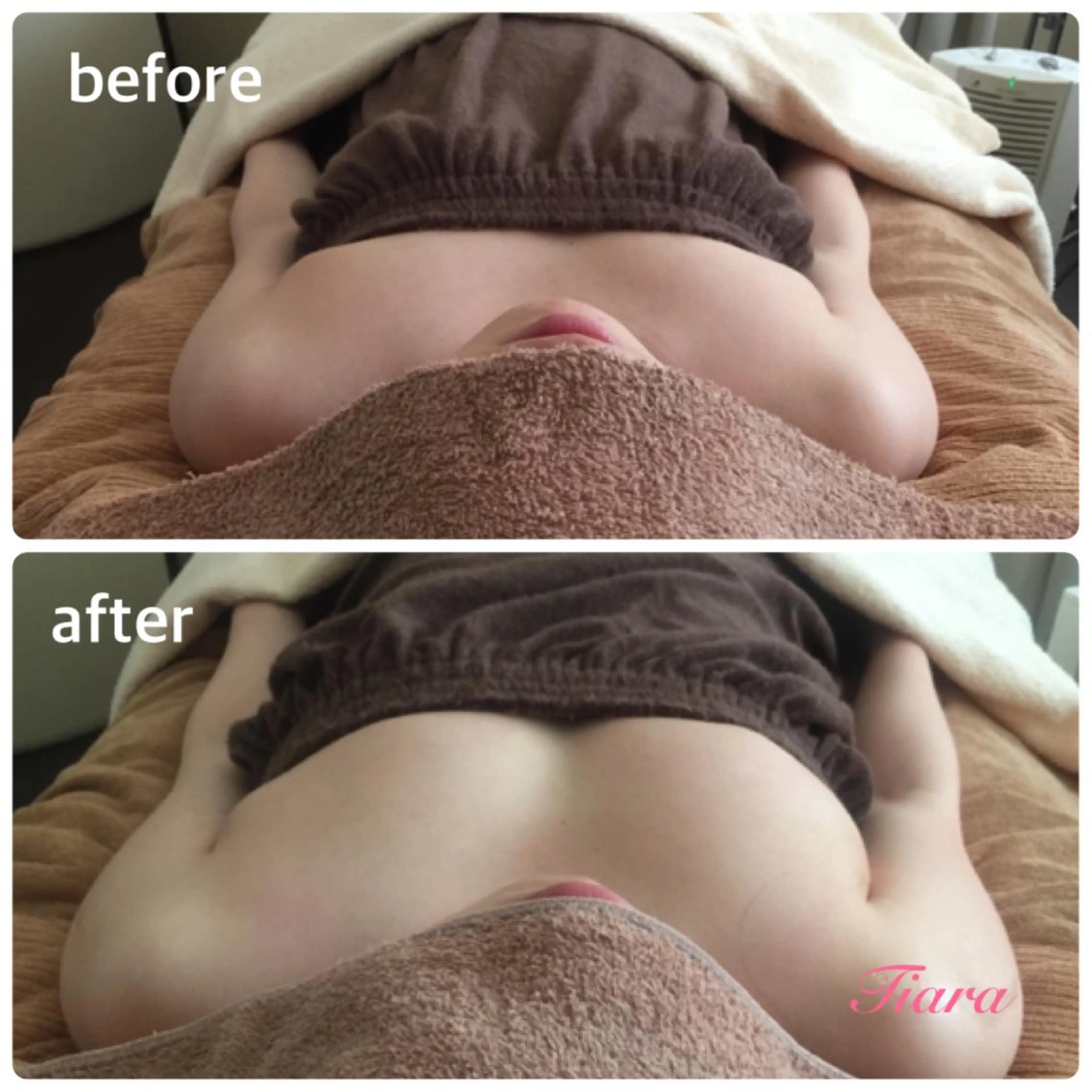 Tiara所属・冨樫 倫子のエステ・リラクイメージ