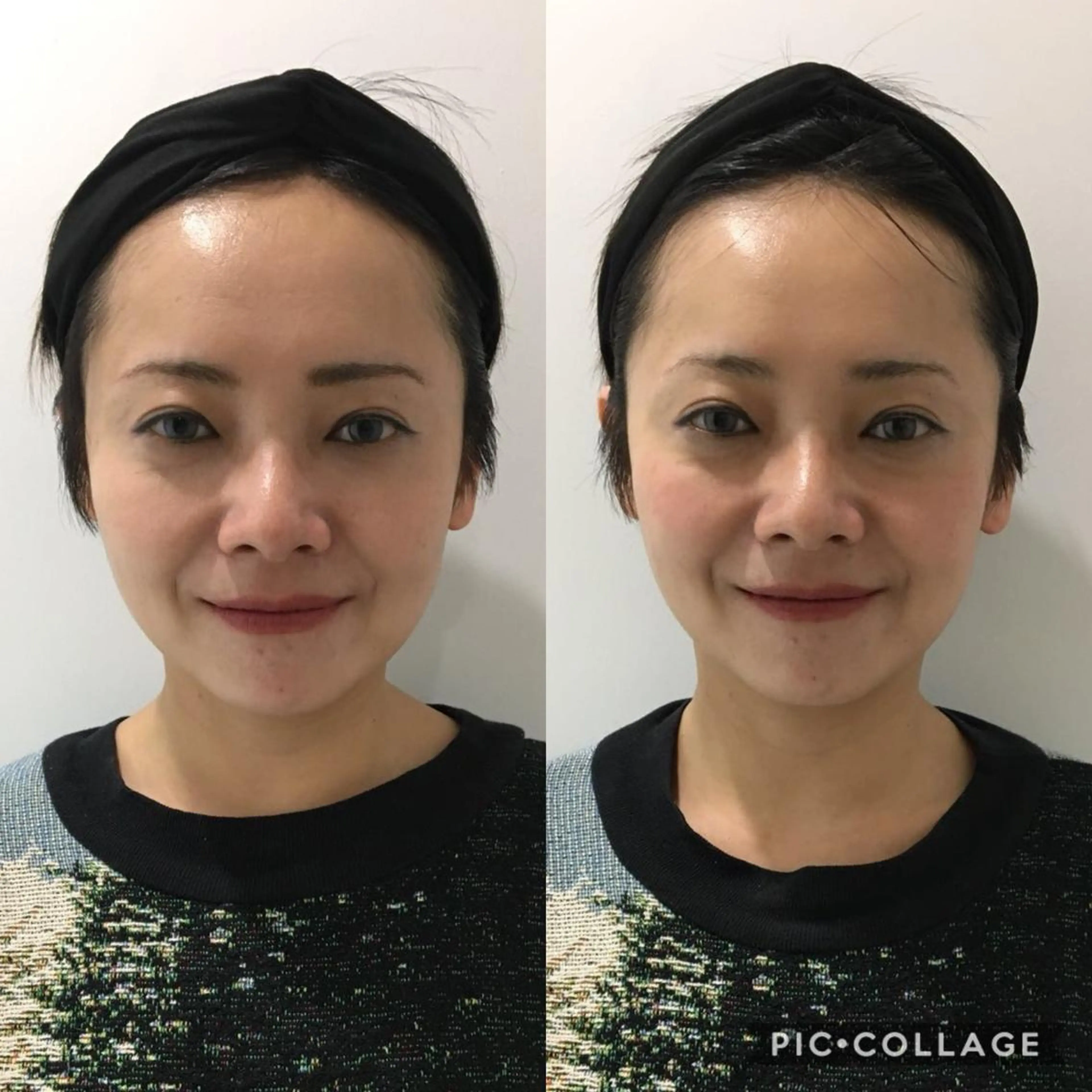 ミディアム 小顔カット 小顔矯正/美容整体 /骨盤矯正✨+Mi2のエステ・リラクイメージ