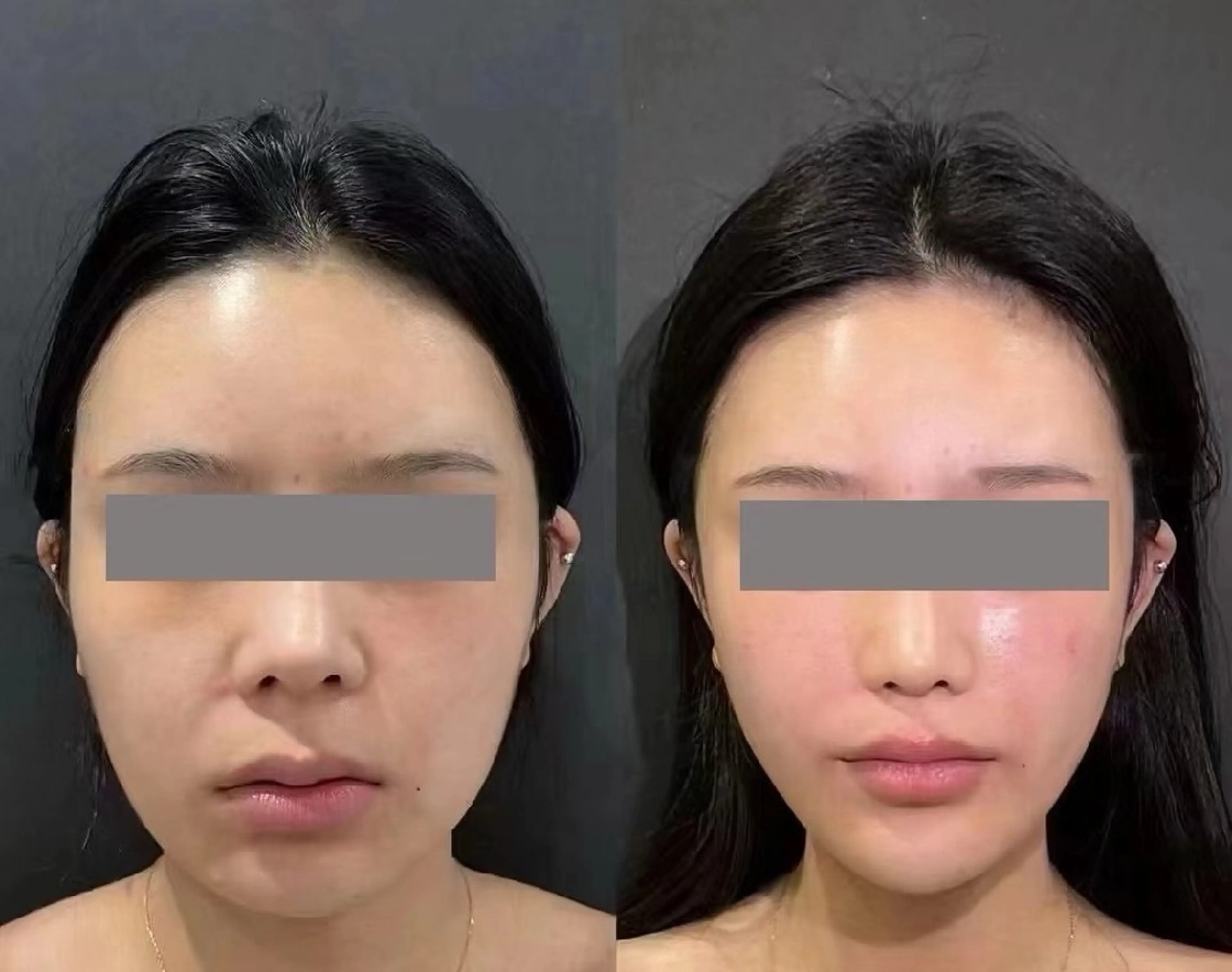 aliaハーブ水光店 エステティシャン募集のエステ・リラクイメージ