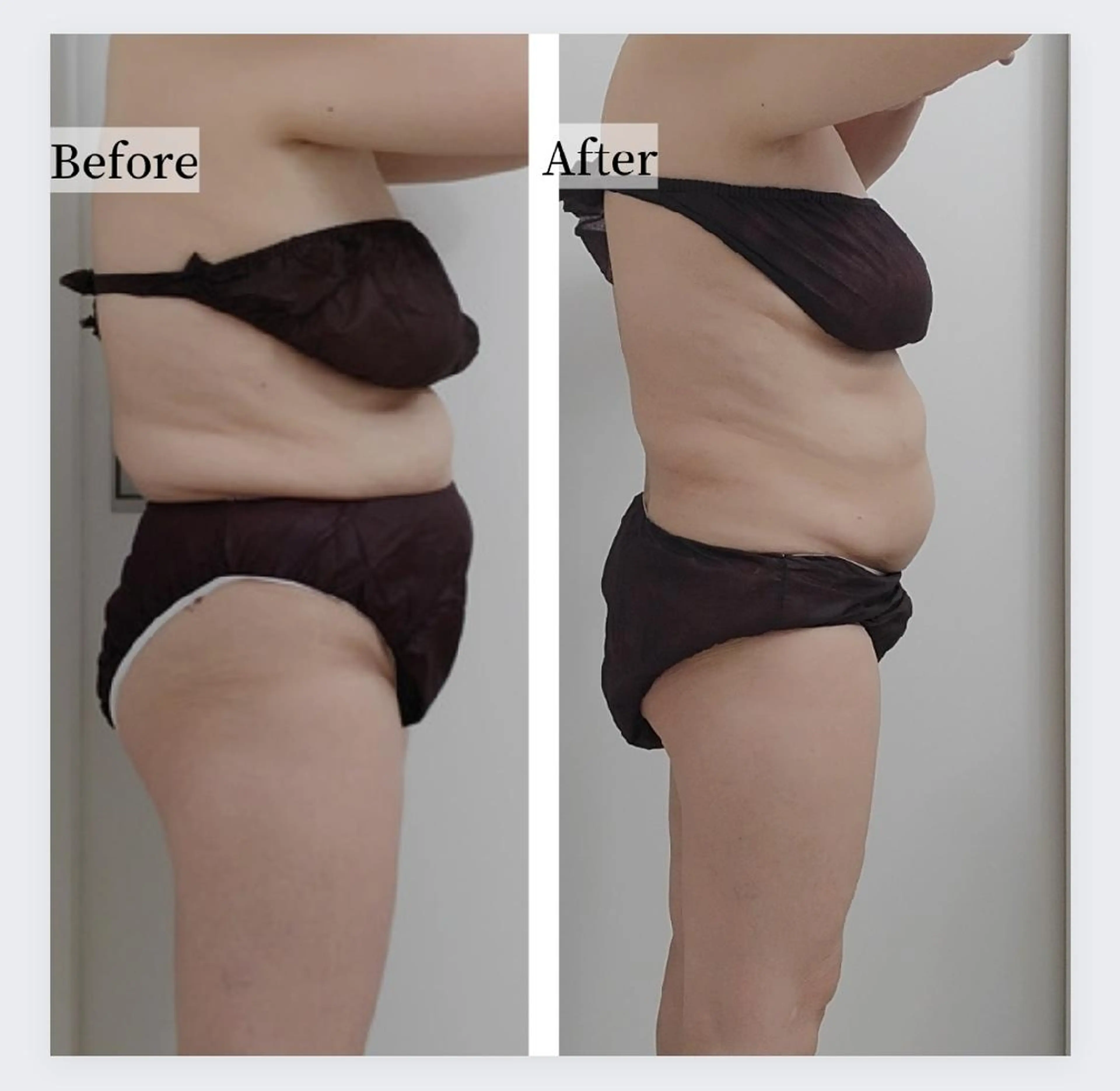 佐賀痩身エステ/小顔 @uni.clearのエステ・リラクイメージ