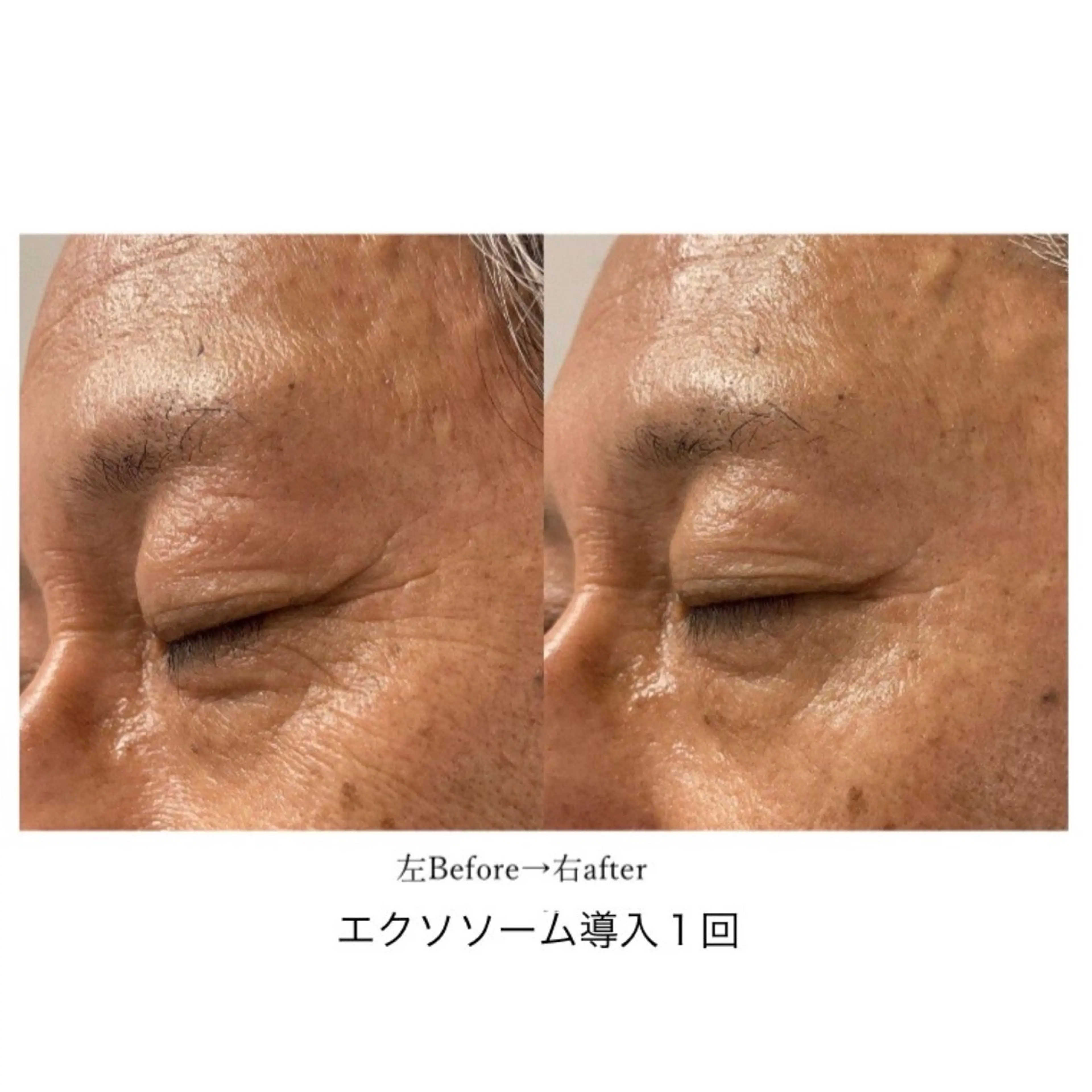 エステ ﾌﾟﾗｲﾍﾞｰﾄｻﾛﾝ アンクチュール所属・UnCouture 〜アンクチュール〜のエステ・リラクイメージ