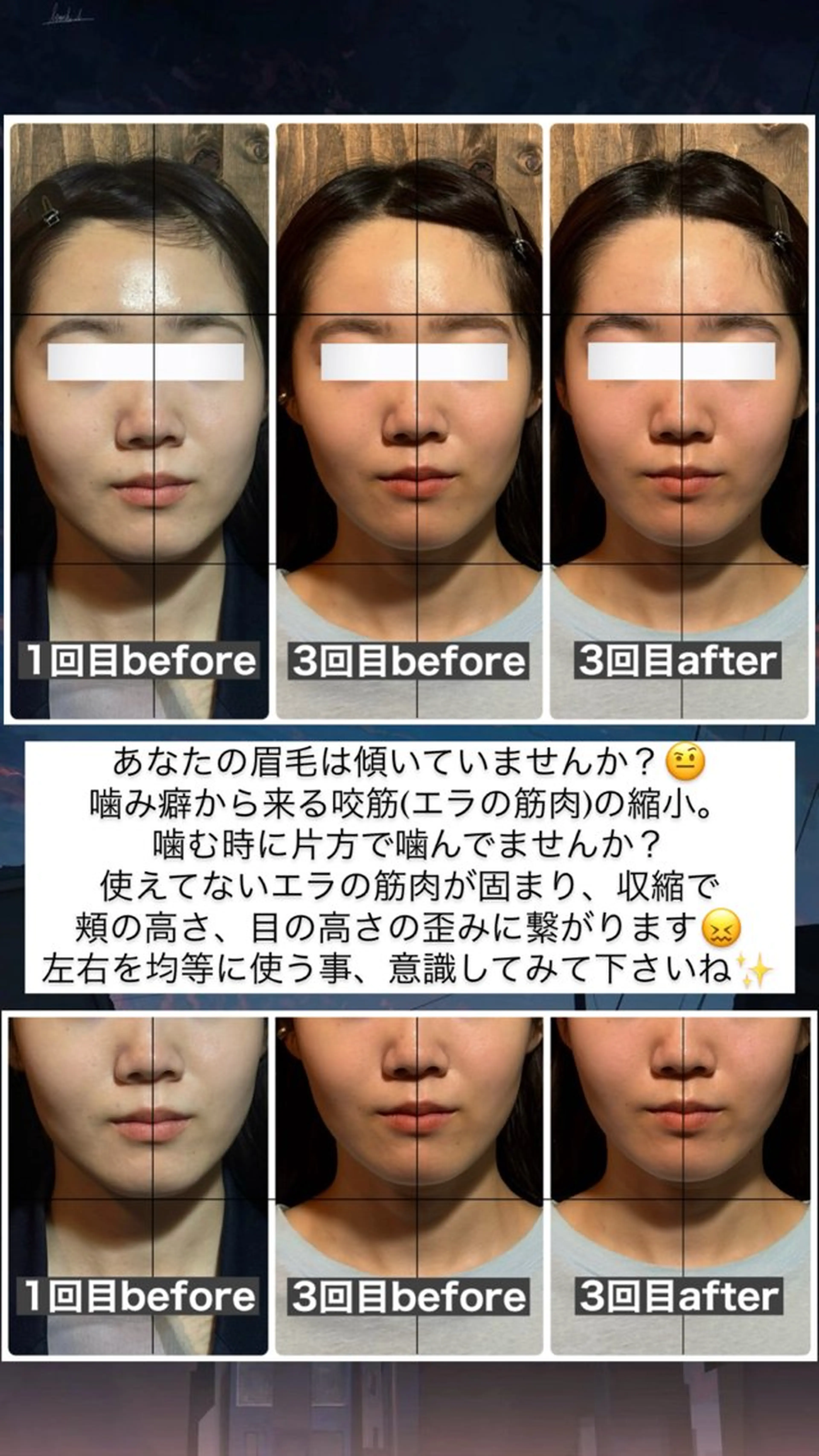 エステ リラク 💎後悔させない小顔 矯正💎イトヤマ🌱のエステ・リラクイメージ