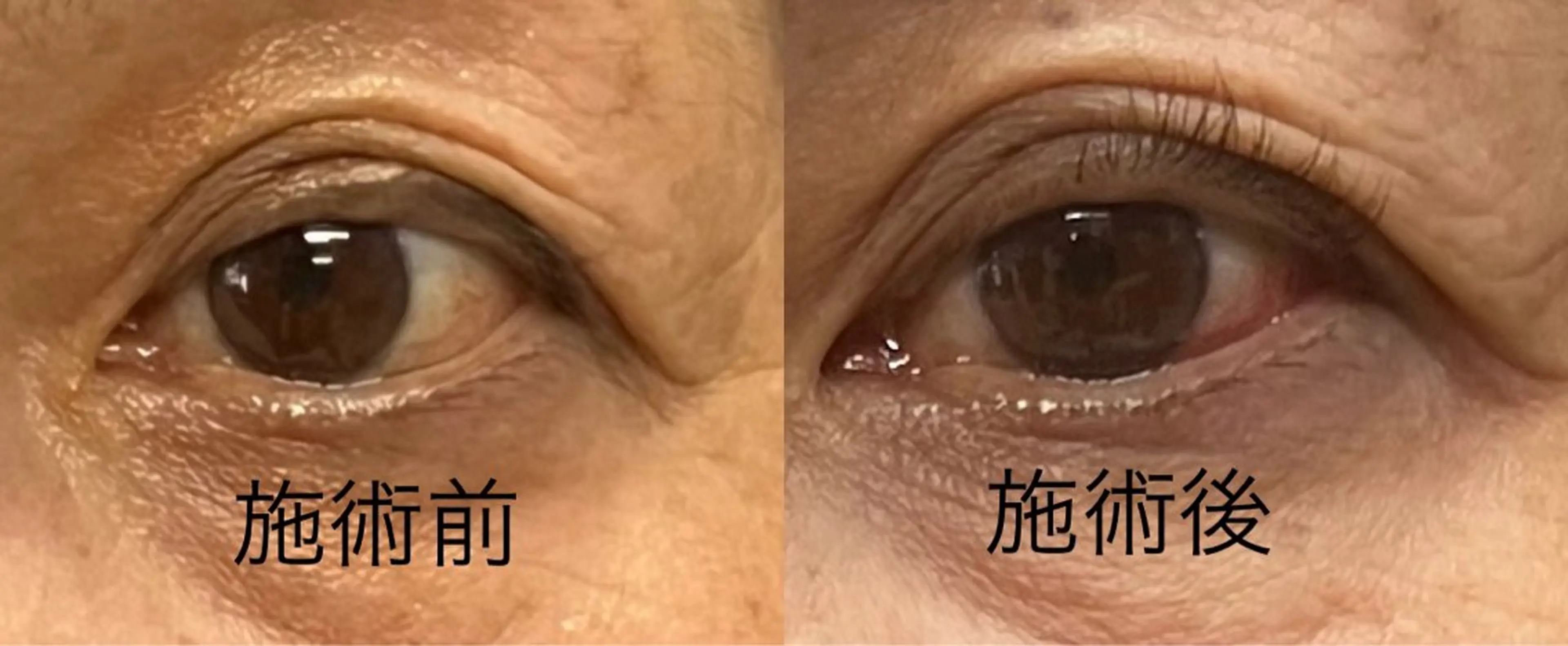 マツエク・マツパ まつげパーマ ✨デトックス職人✨ To-Hiらぼのヘアスタイル