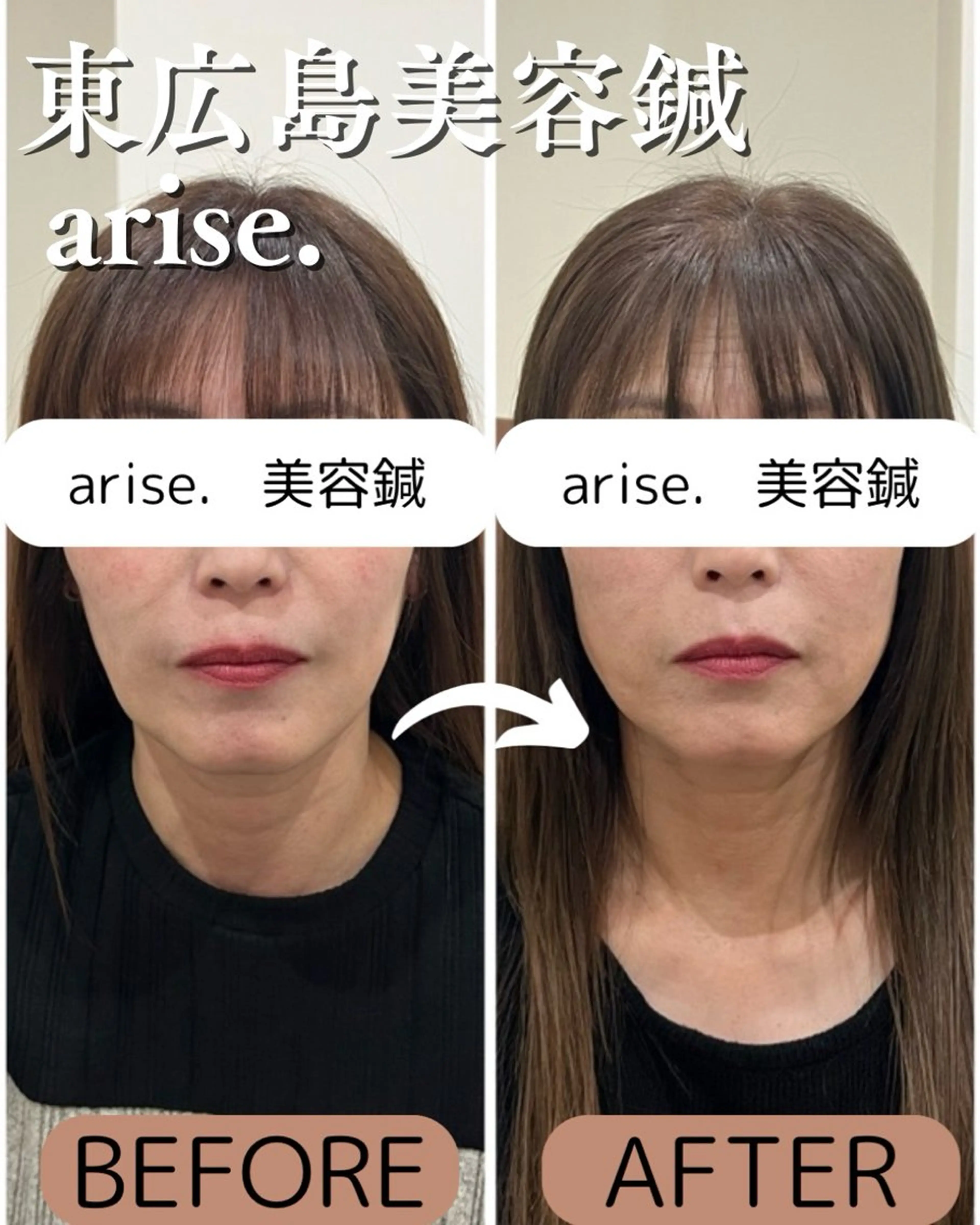 その他 東広島美容鍼 /arise.のその他イメージ