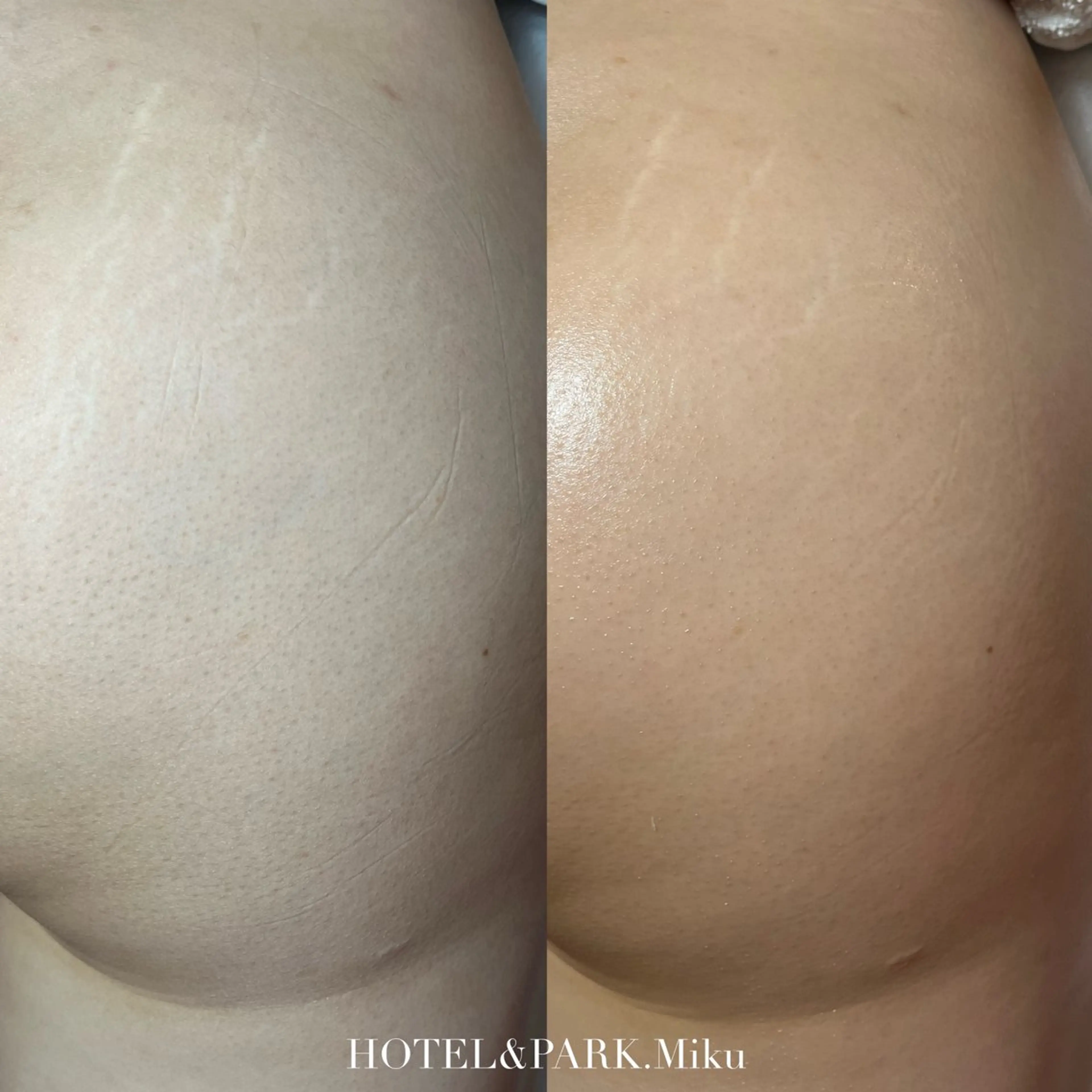 HOTEL&PARK Mikuワックス脱毛のエステ・リラクイメージ