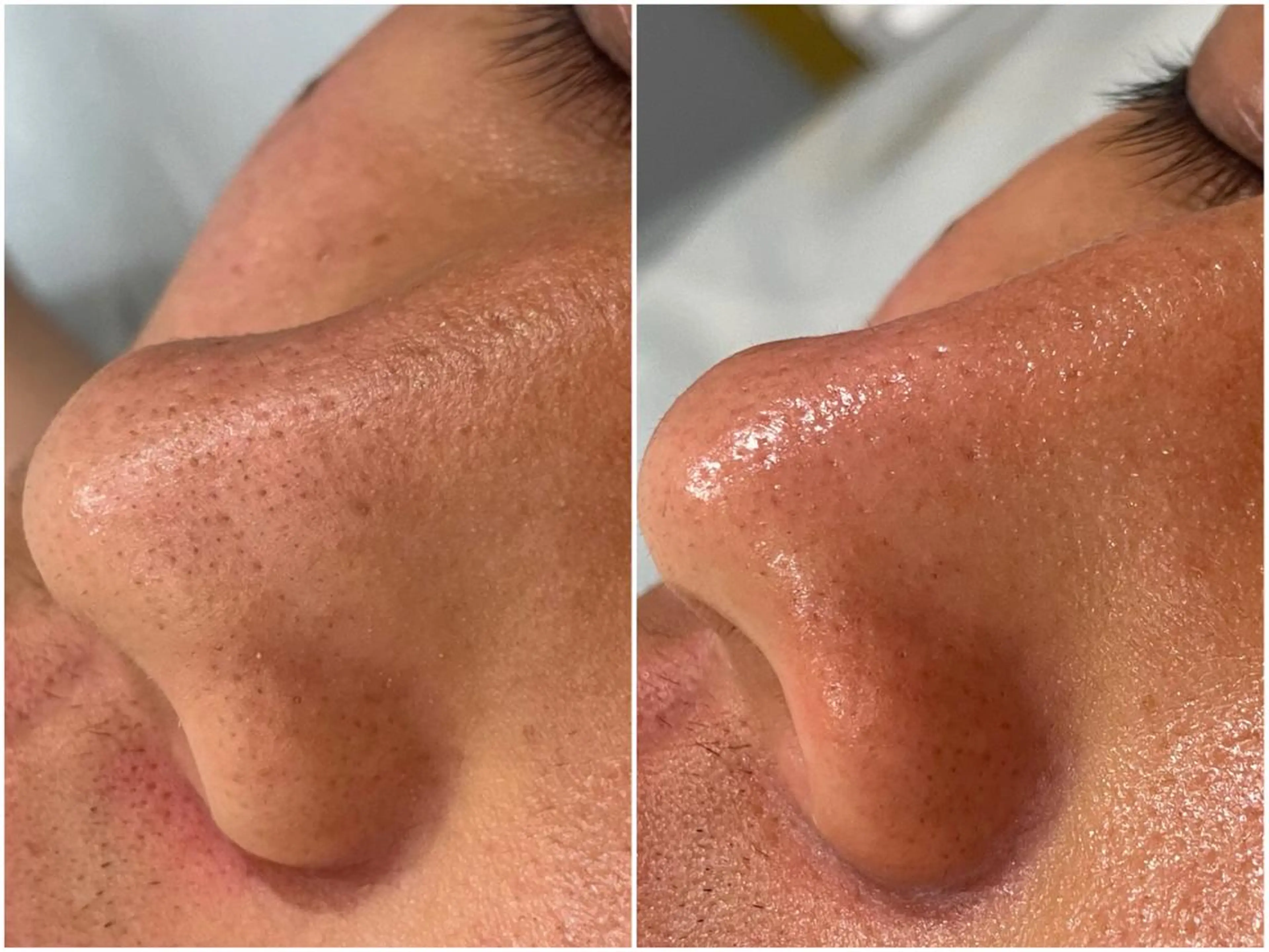 エステ 産後/ツヤ肌/子連れ /保育士在籍サロンのエステ・リラクイメージ