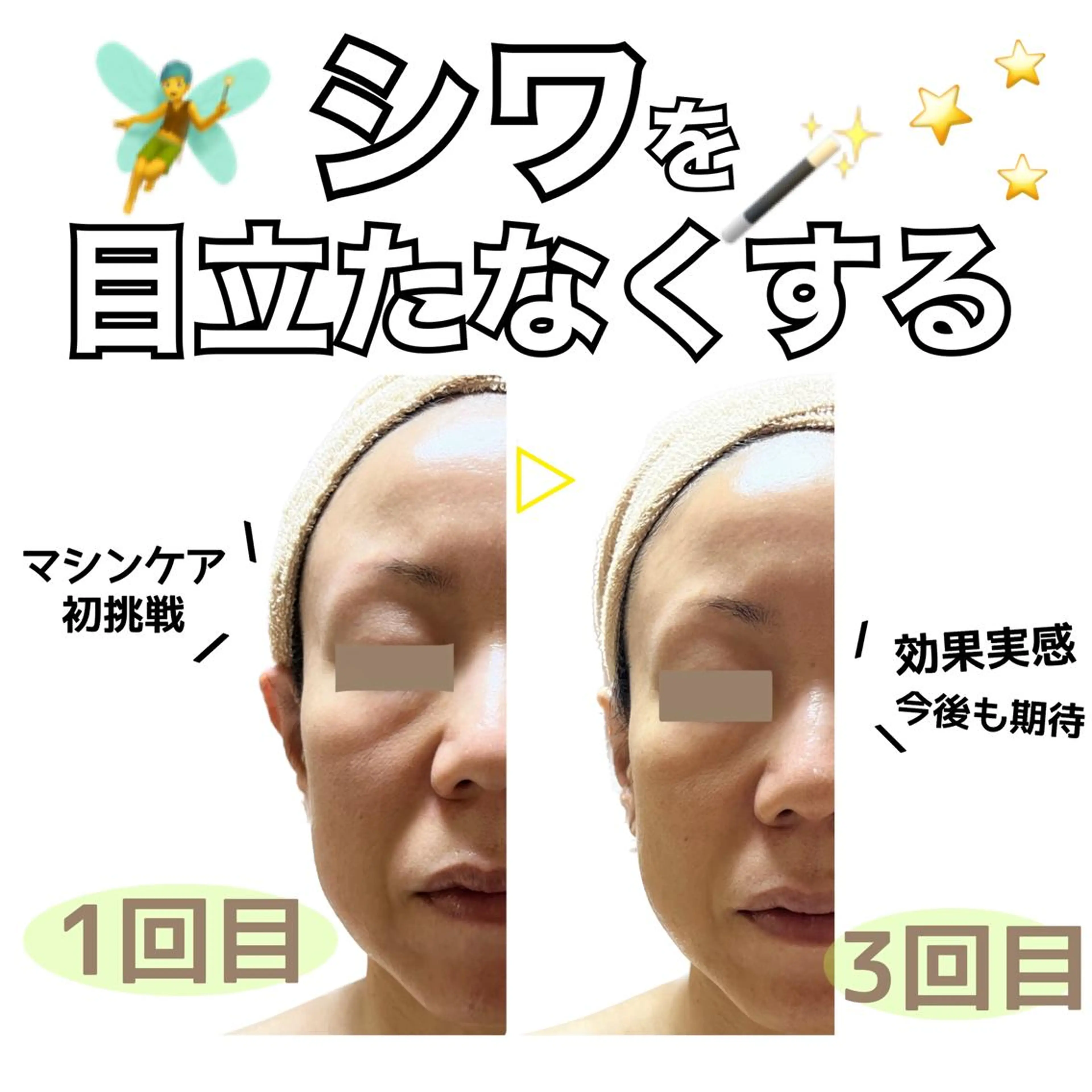 stella都度払い 痩身小顔まつげパーマのマツエク・マツパデザイン