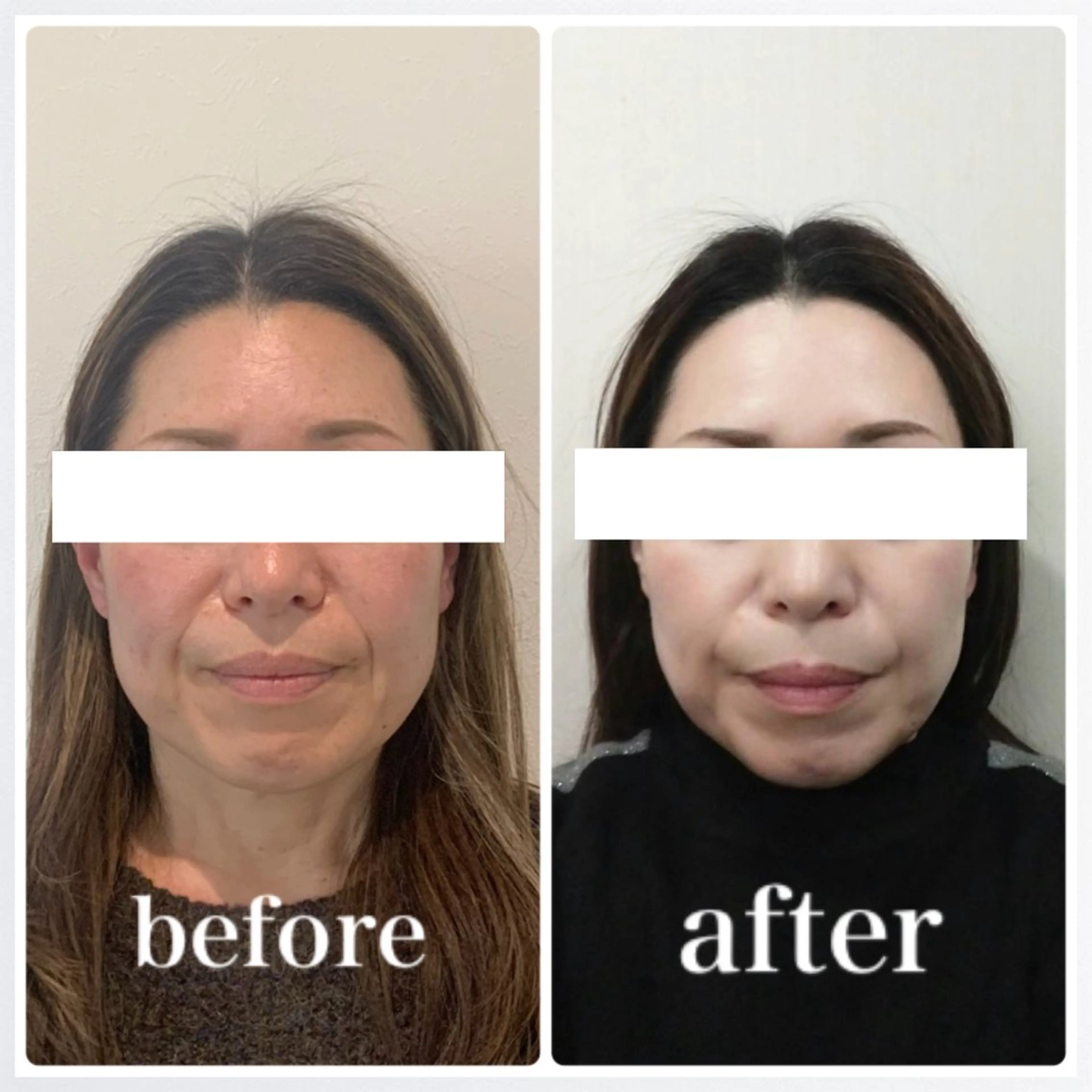 エステ リラク 小顔と ヘッドスパのお店のエステ・リラクイメージ