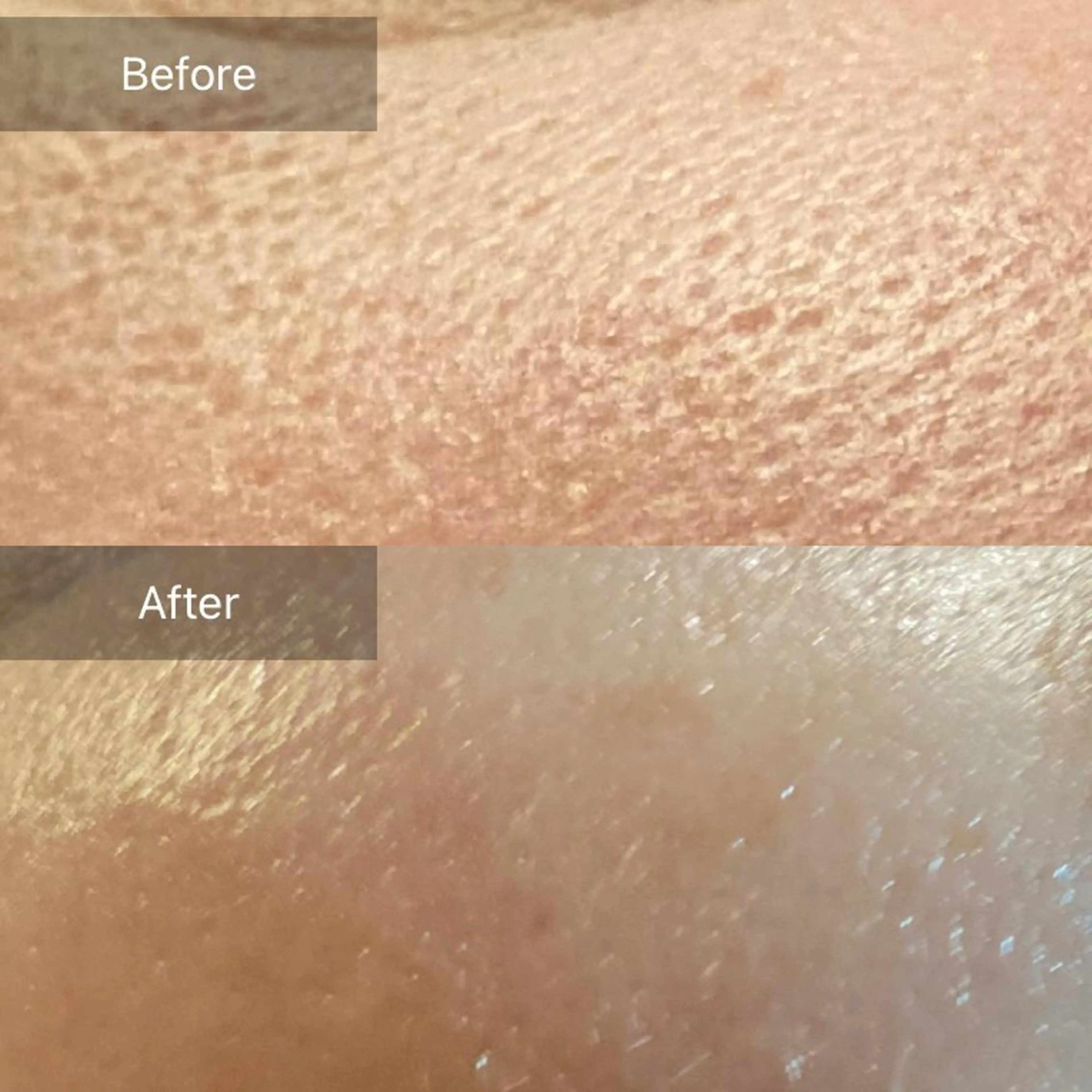 Mandarin Orange所属・毛穴から始める肌メン テマンダリンオレンジのエステ・リラクイメージ