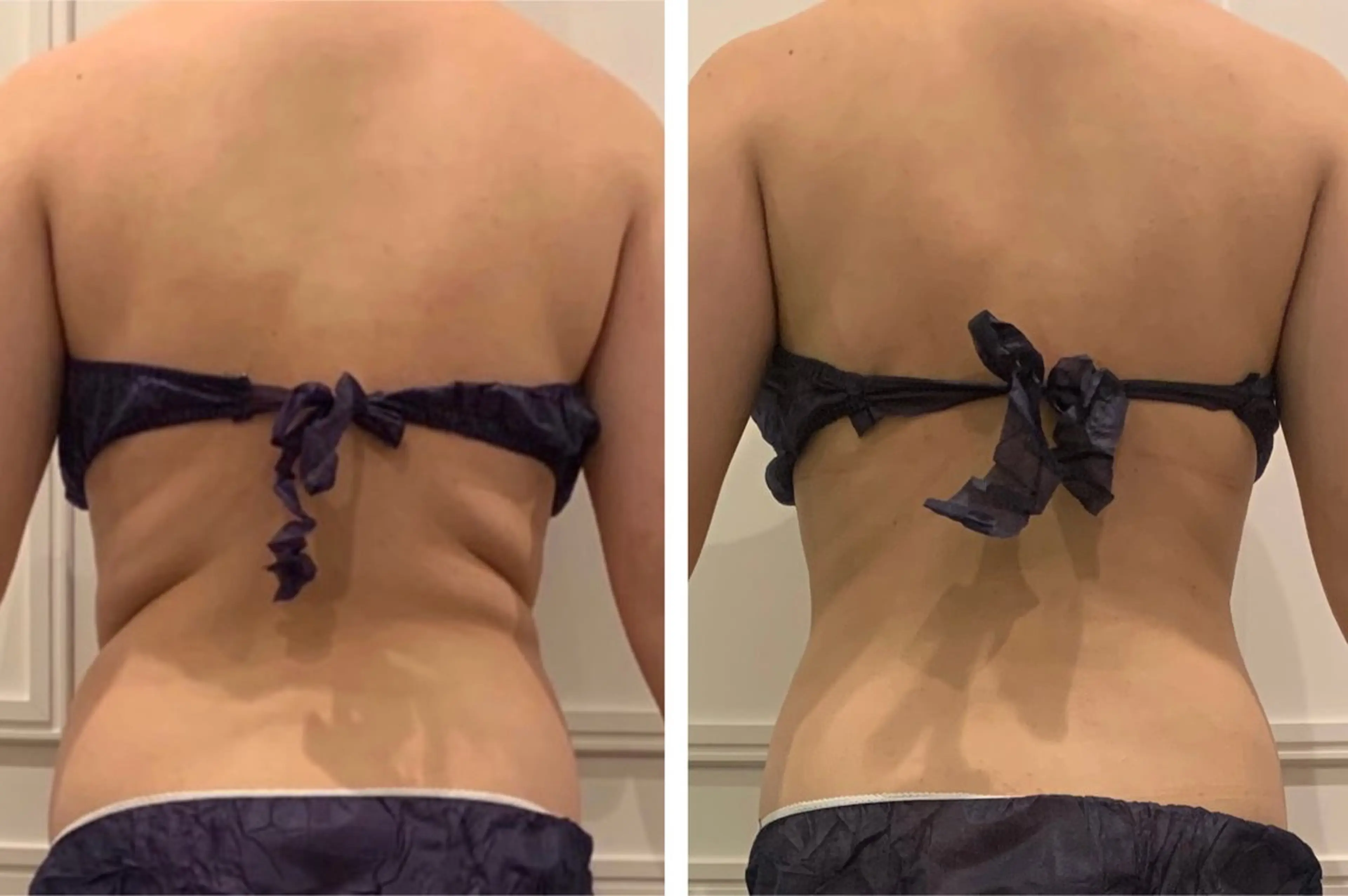 エステ リラク 小顔EX心斎橋 REVIハーブのエステ・リラクイメージ