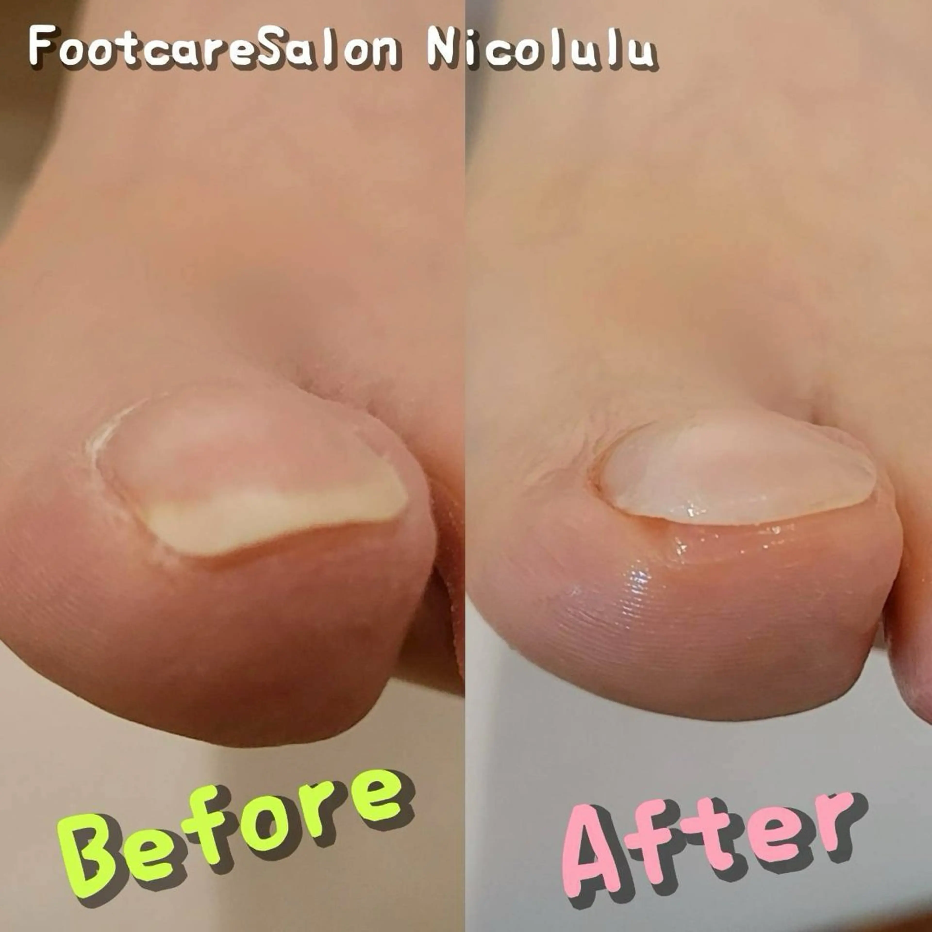 メンズ リラク 足トラブル専門 ニコルル金沢のエステ・リラクイメージ