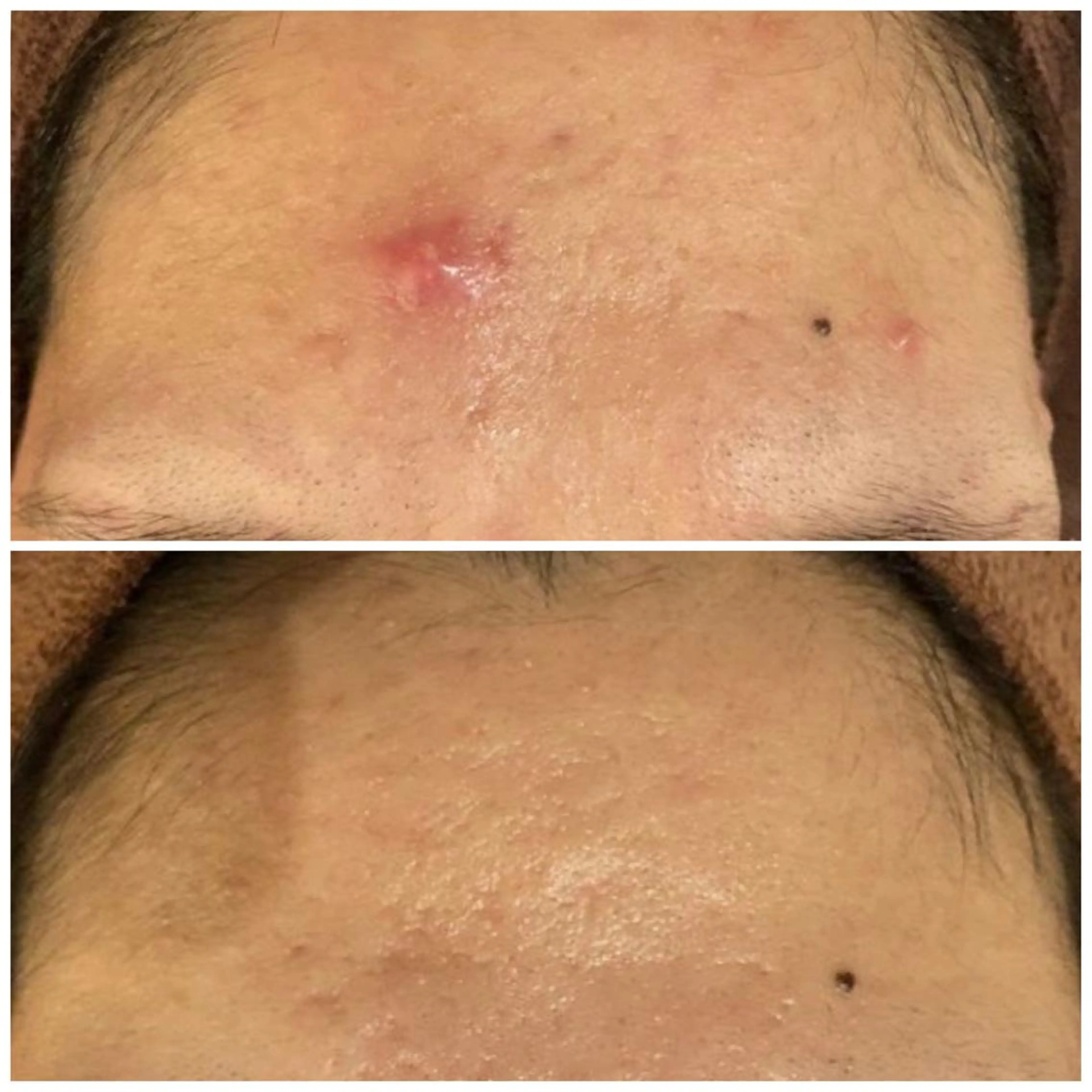 セミロング カラー パーマ ヘアアレンジ メンズ キッズ ネイル マツエク・マツパ アイブロウ 3か月で肌革命👼 ニキビ専門店💫のエステ・リラクイメージ