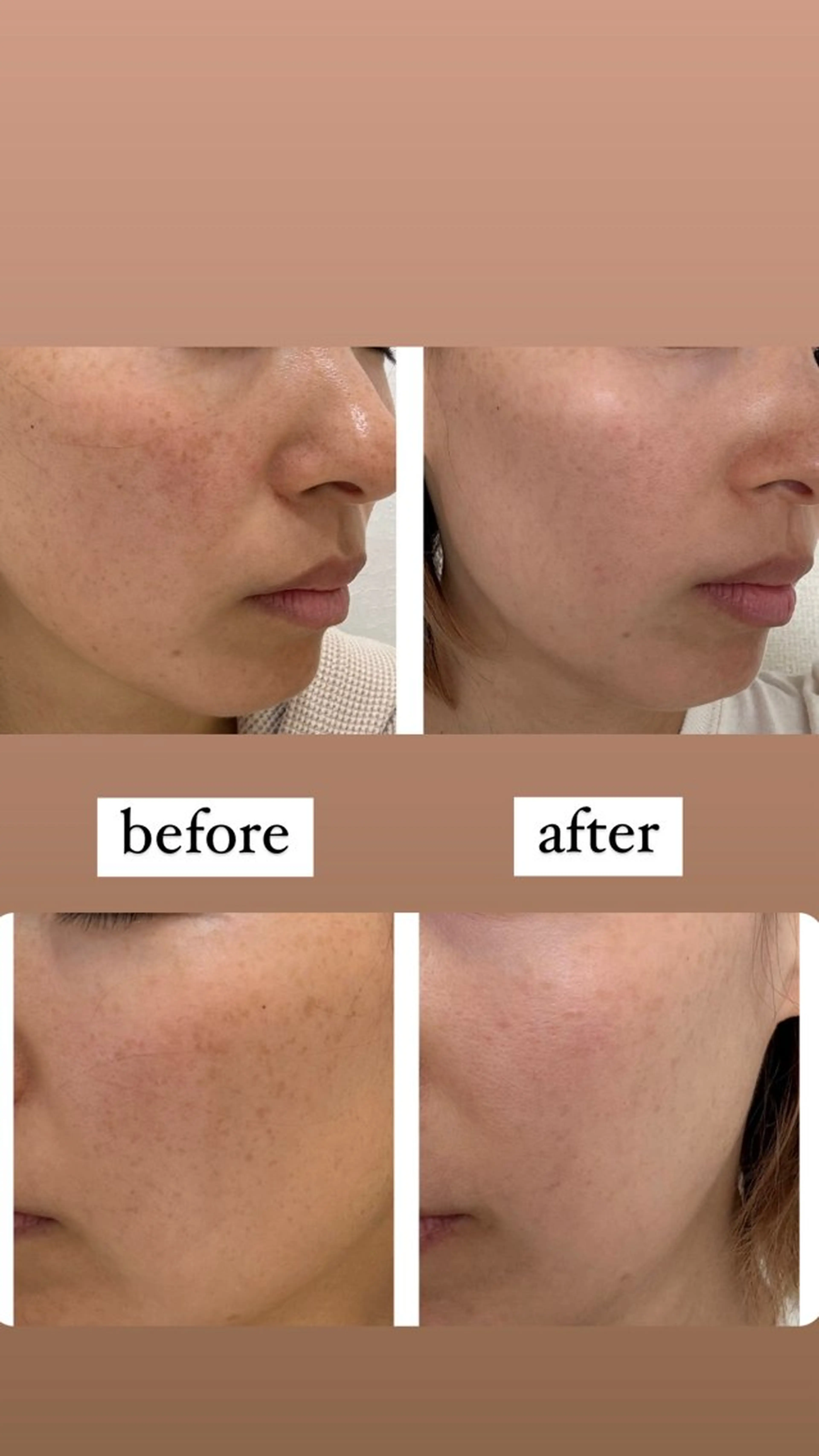 エステ リラク marrina terraceのエステ・リラクイメージ