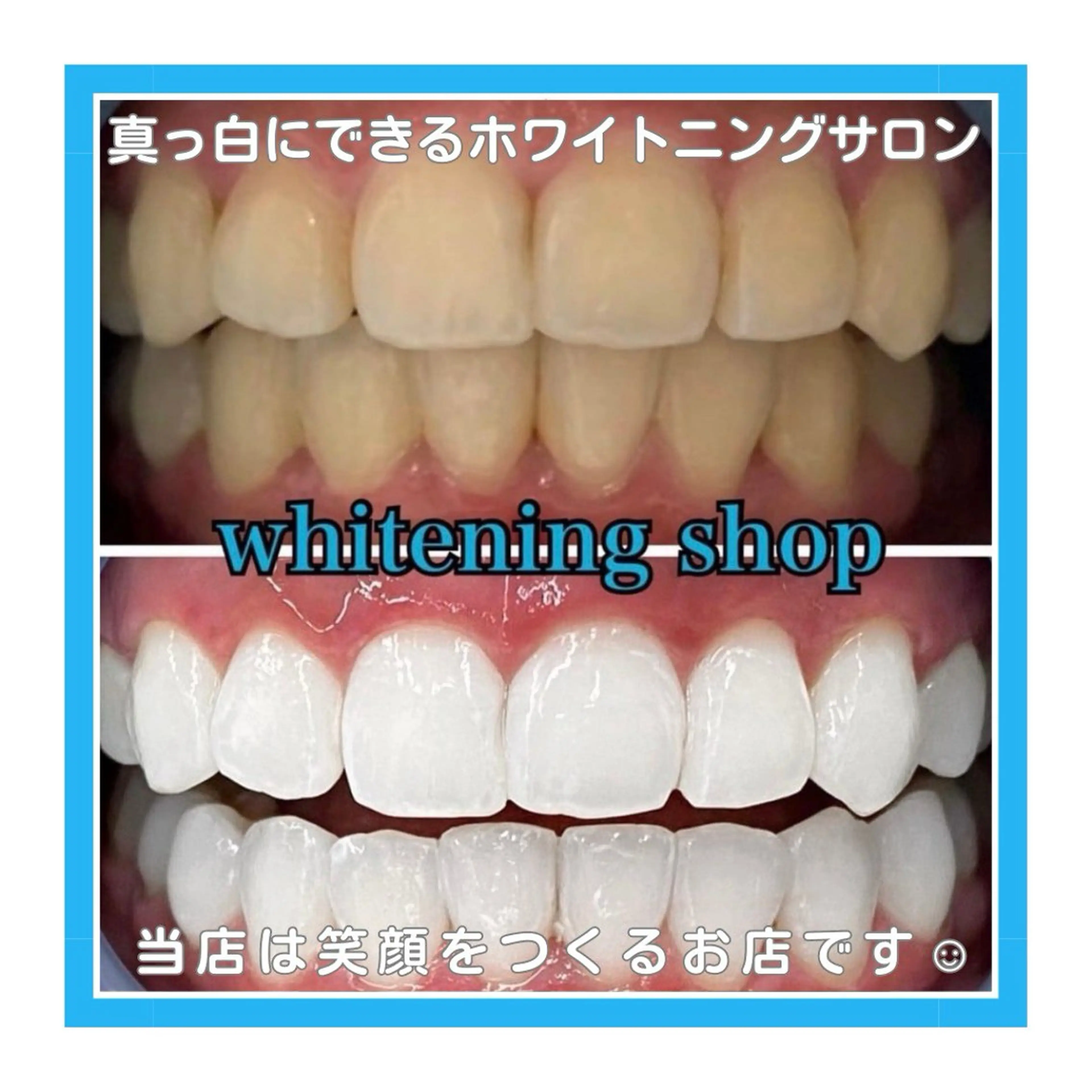 ホワイトニング ショップ浦和店のその他イメージ