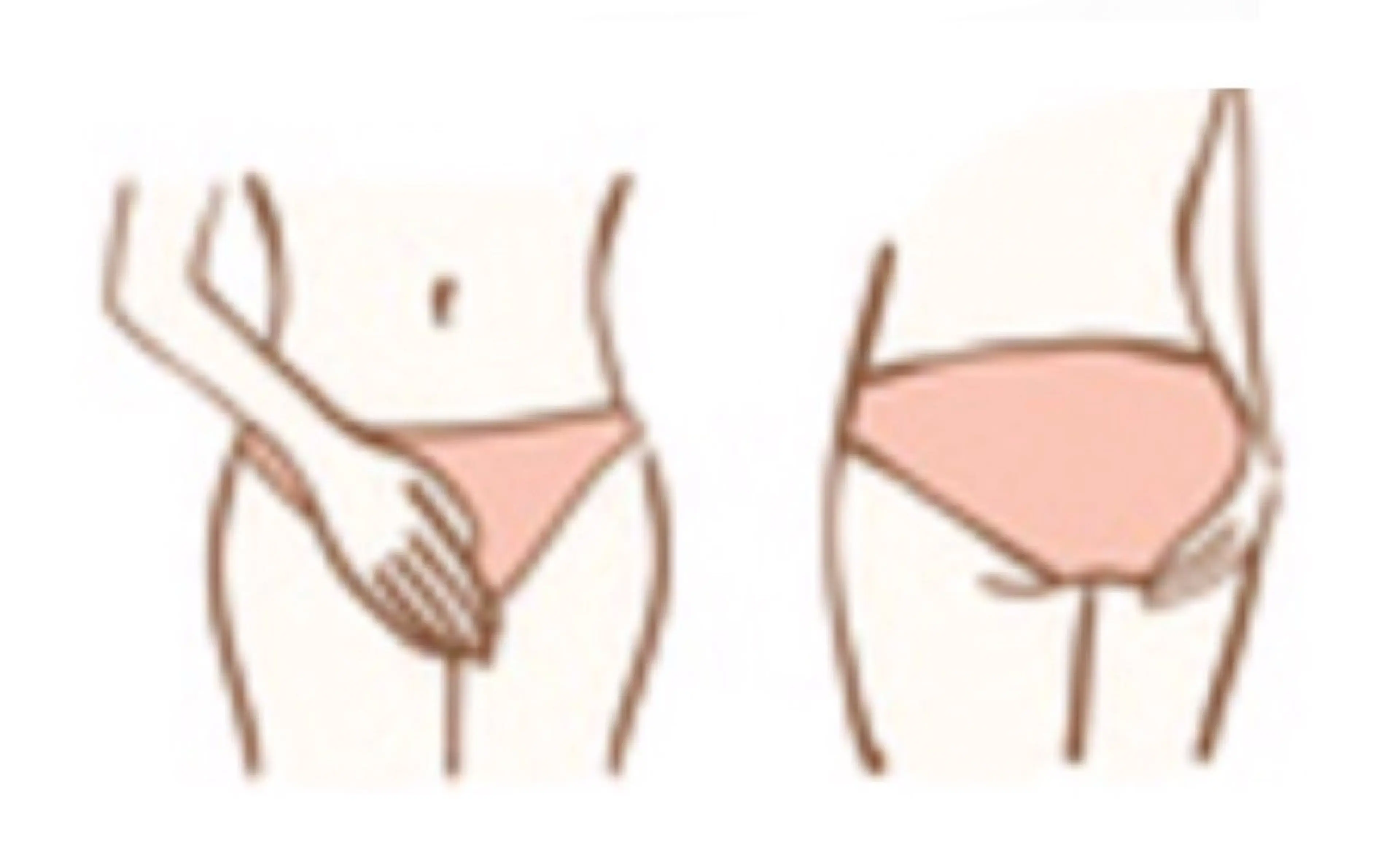【VIO(デリケートゾーン)セット光脱毛👙】の写真