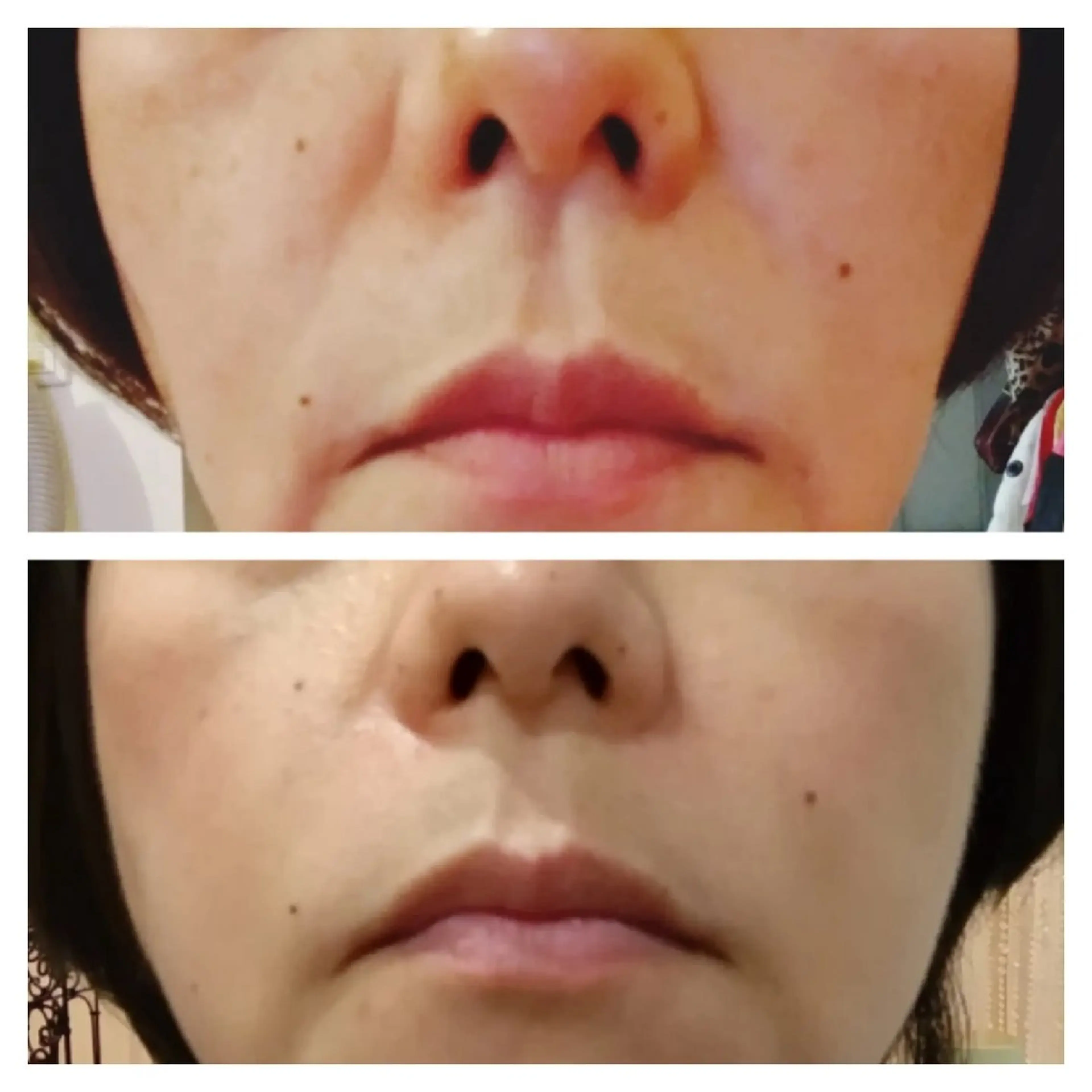 エステ MAXまつ毛&  フェイシャルのマツエク・マツパデザイン