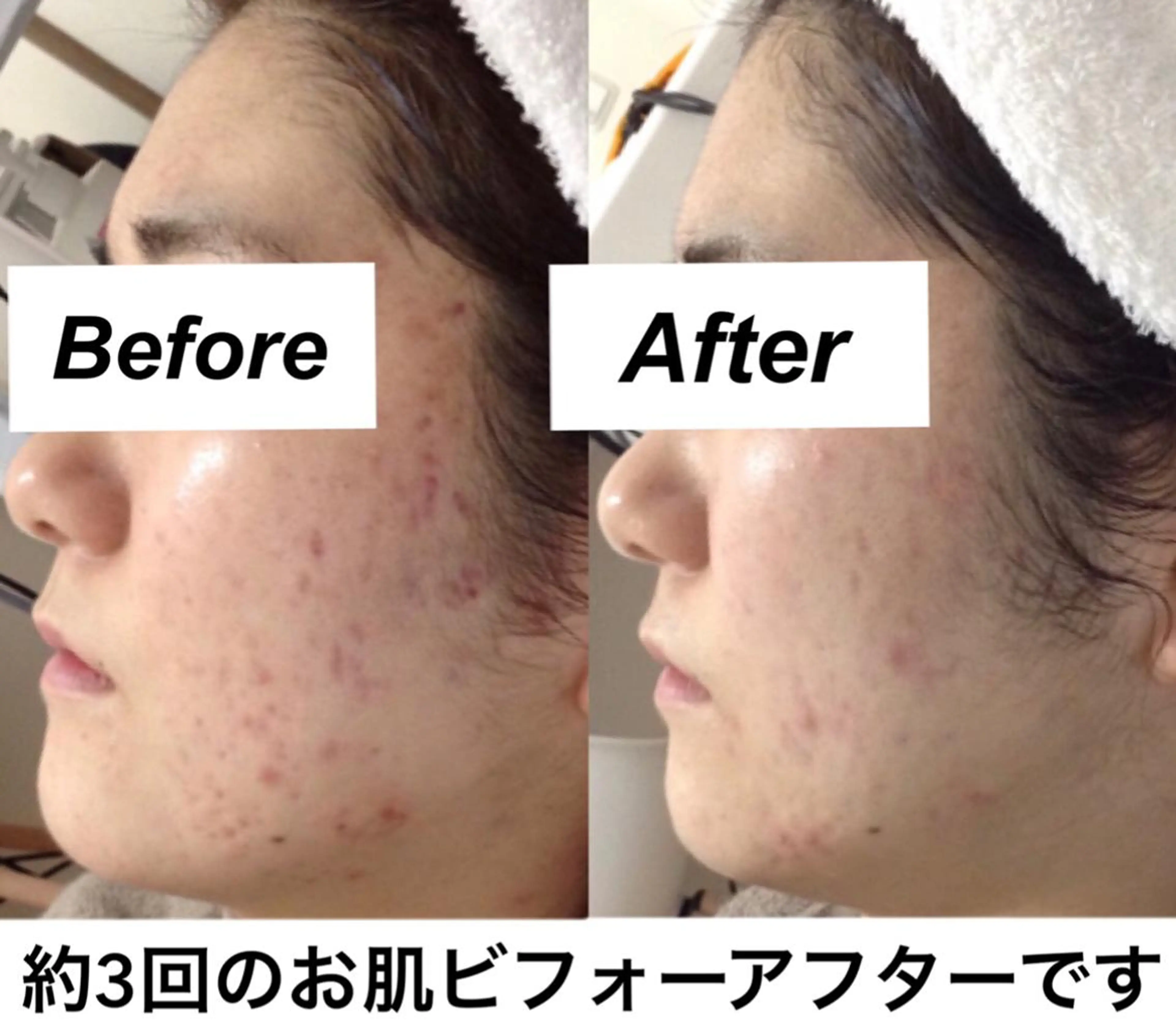 エステ リラク 都度払い肌質改善 &脱毛Blancheのエステ・リラクイメージ