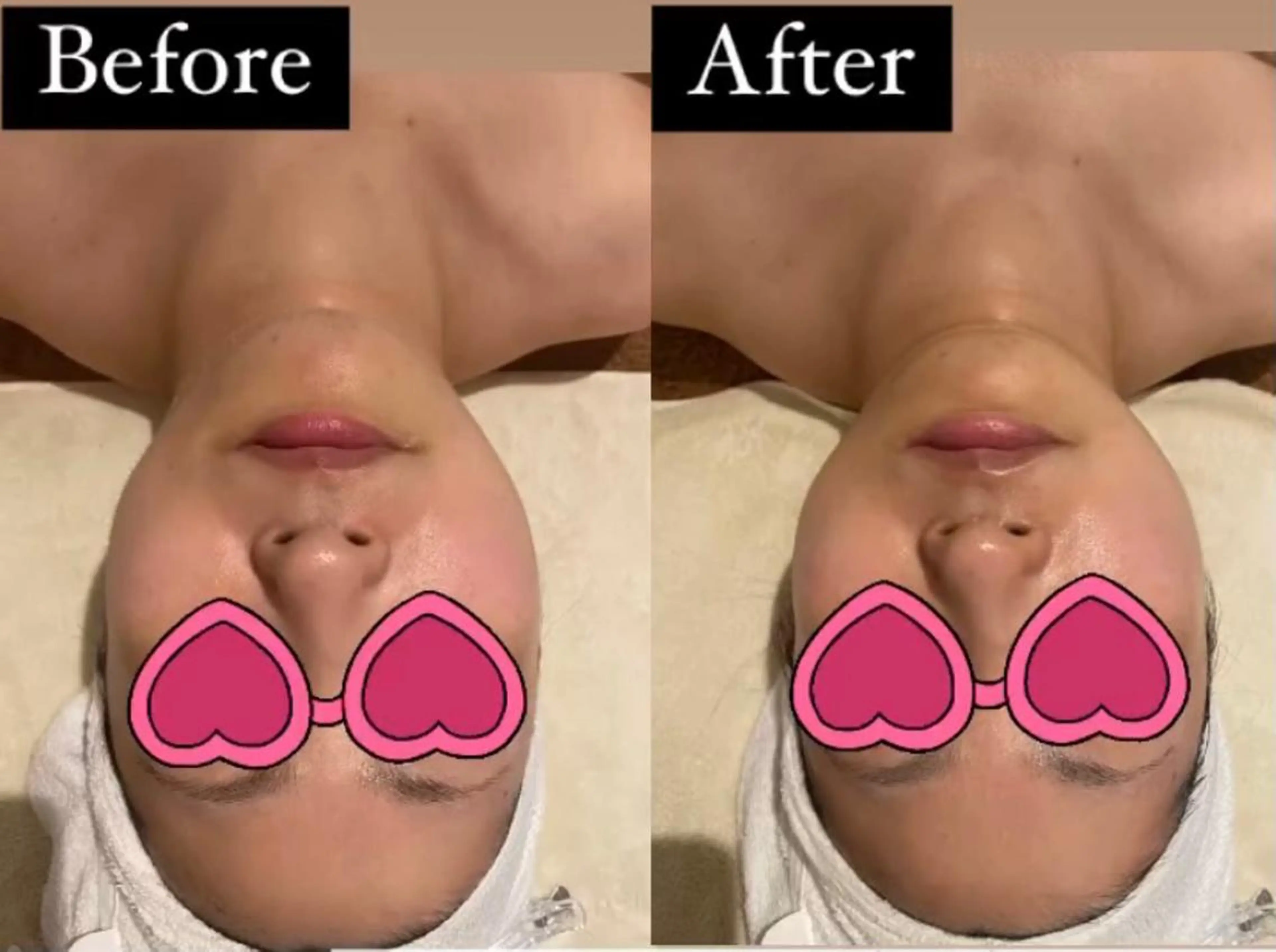 エステ リラク MENARD BLOOMのエステ・リラクイメージ