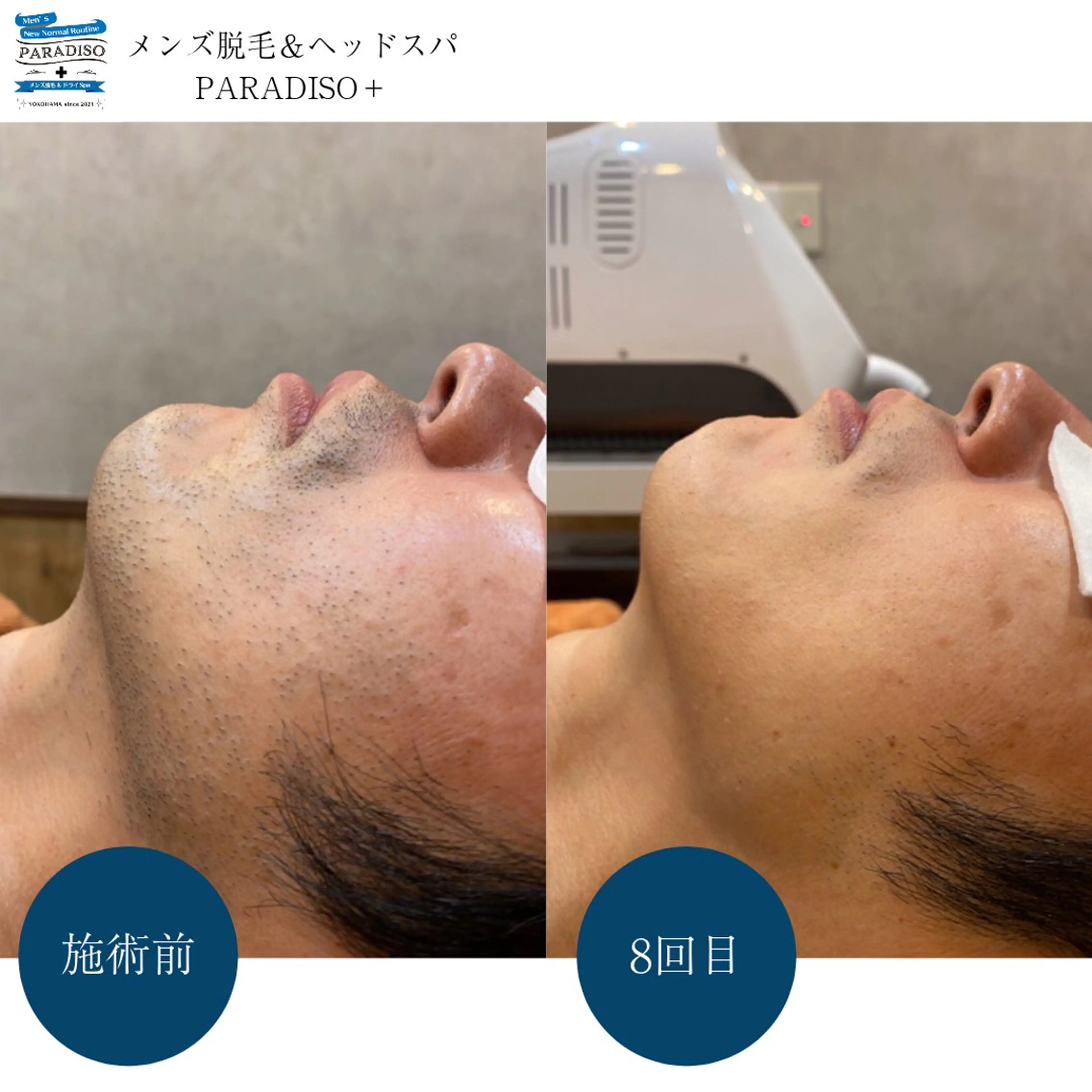 メンズ 後藤 まりやの眉毛・アイブロウイメージ