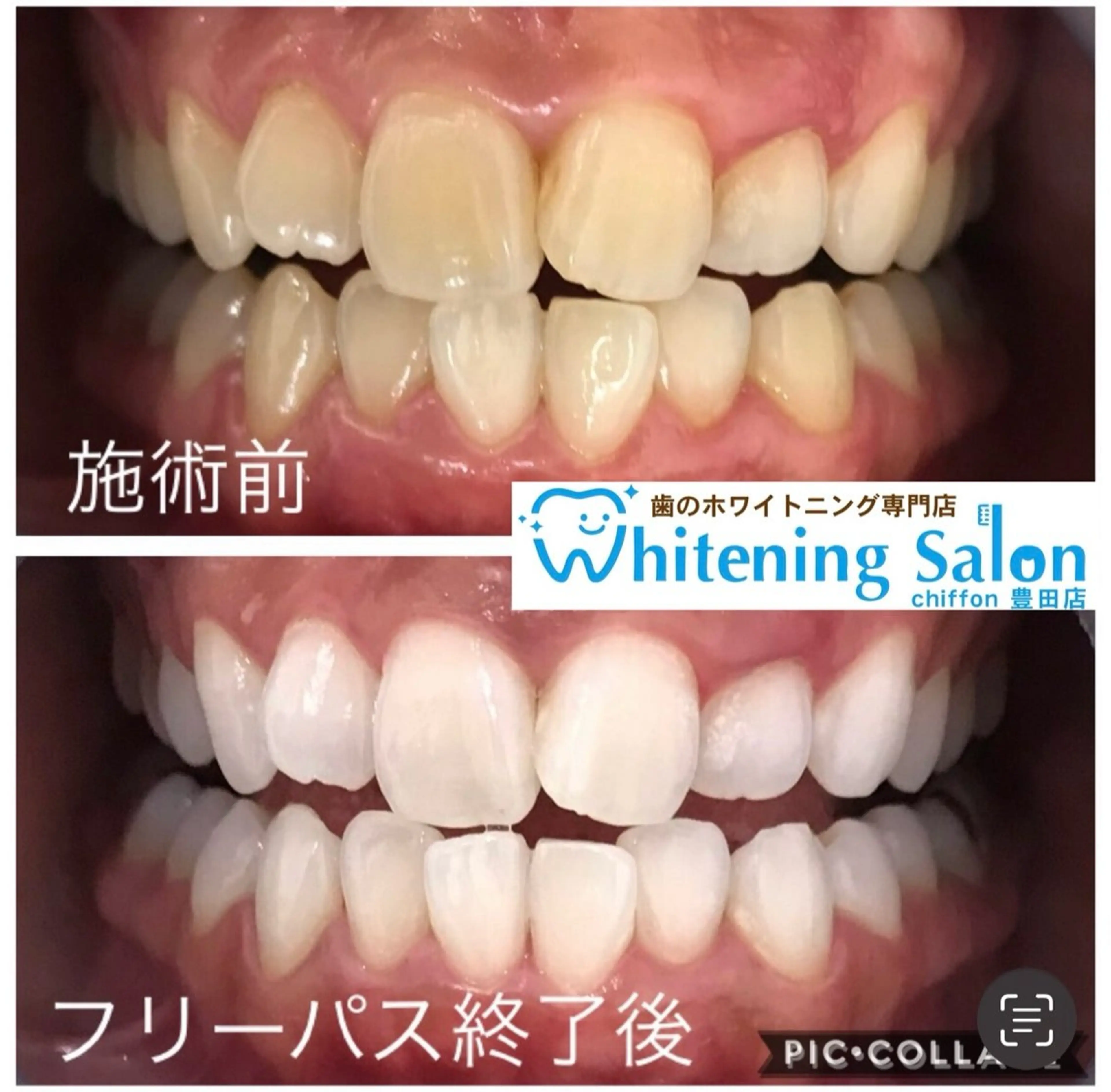 ホワイトニングサロン シフォン豊田店のエステ・リラクイメージ