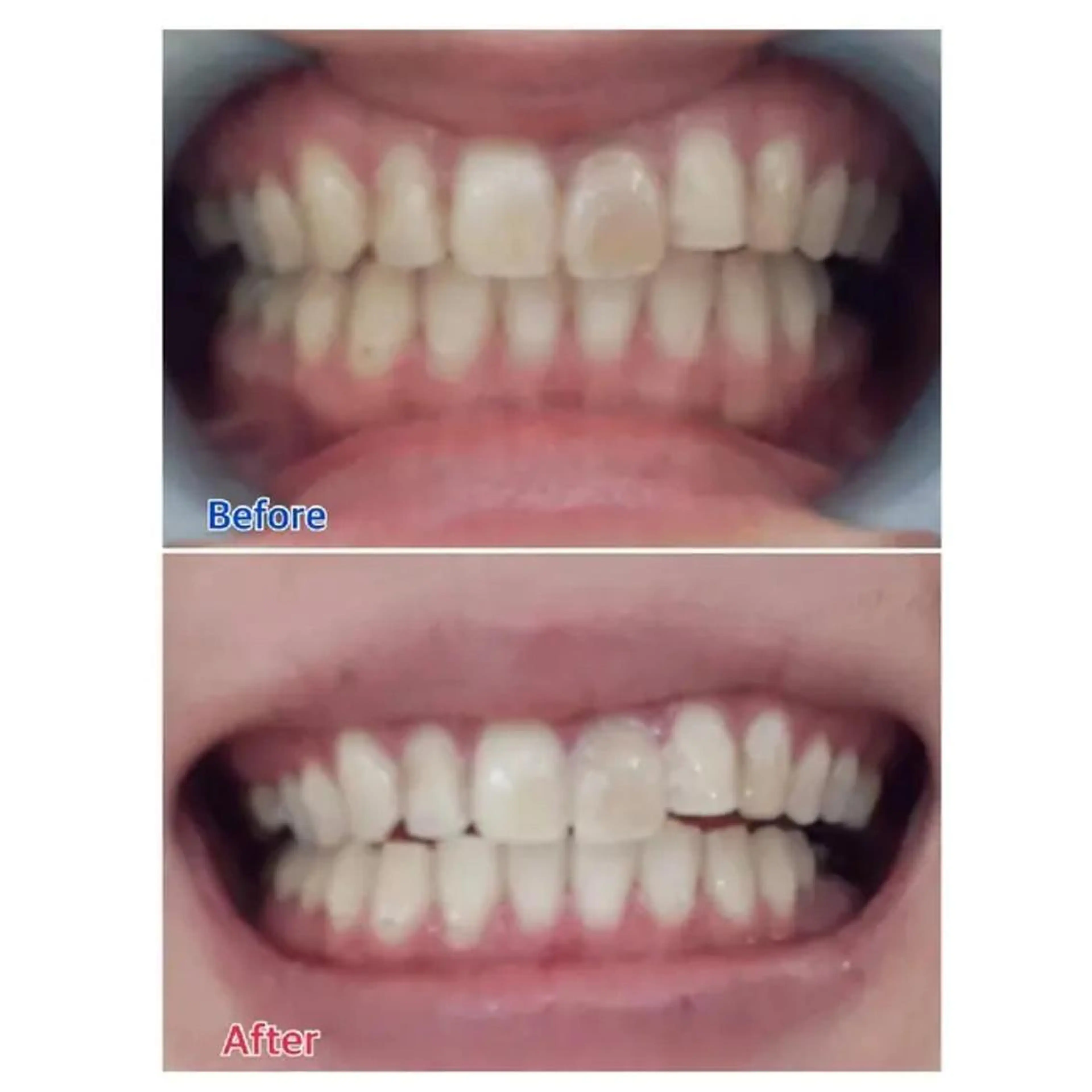 M渋谷 ホワイトニングのエステ・リラクイメージ