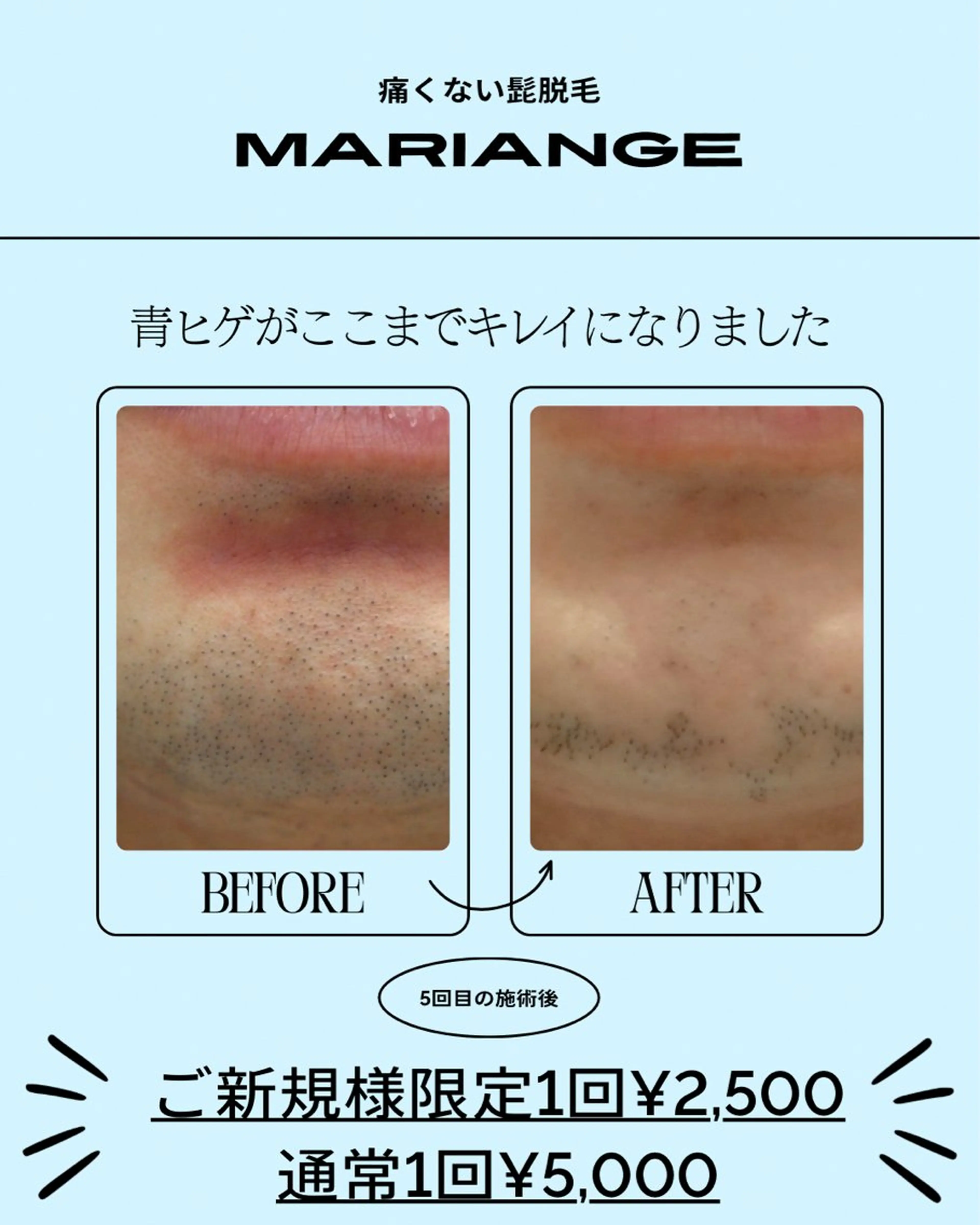 メンズ 脱毛 mariange 〜美肌・美容脱毛〜のエステ・リラクイメージ