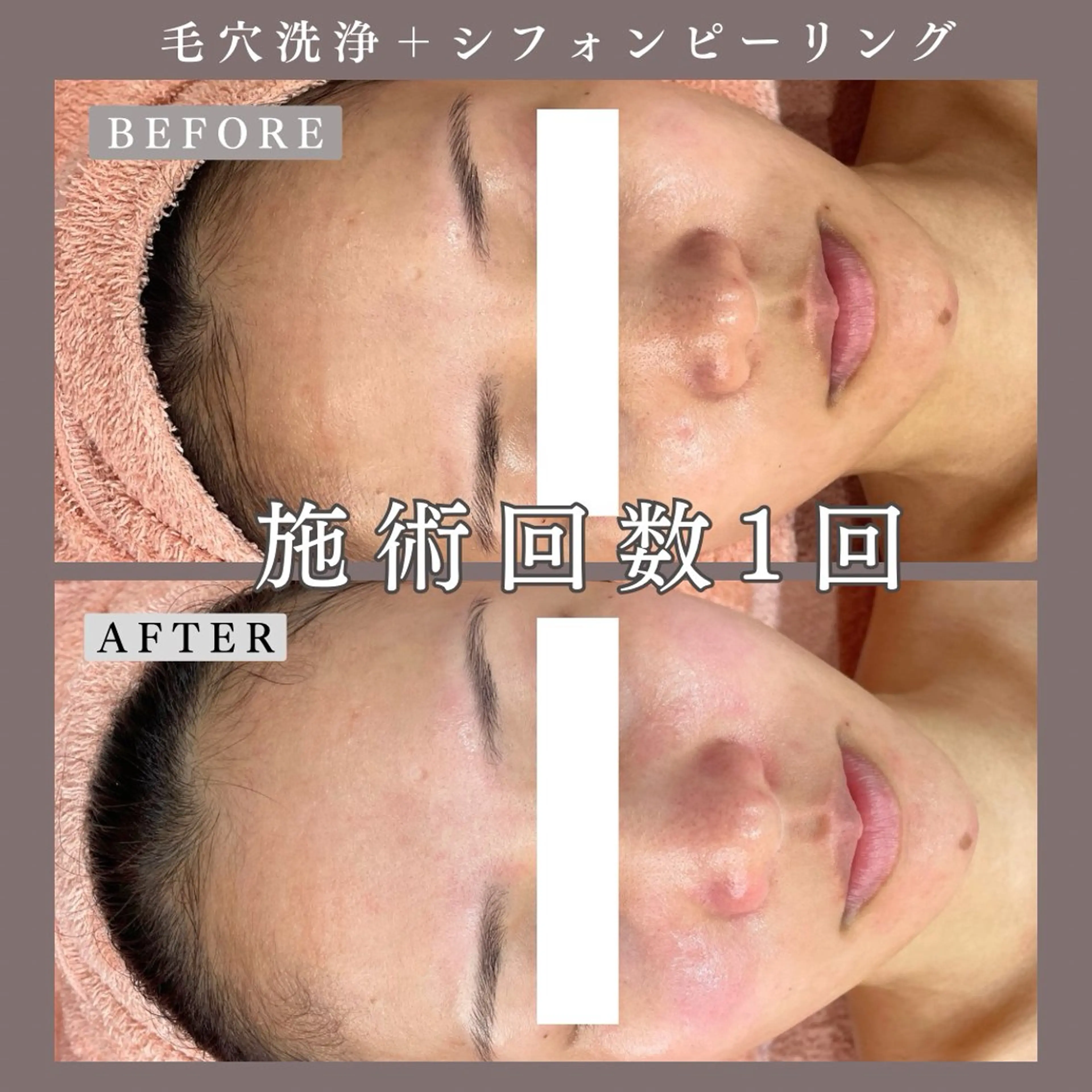 エステ 肌質改善専門サロン Bellmi/心斎橋のエステ・リラクイメージ