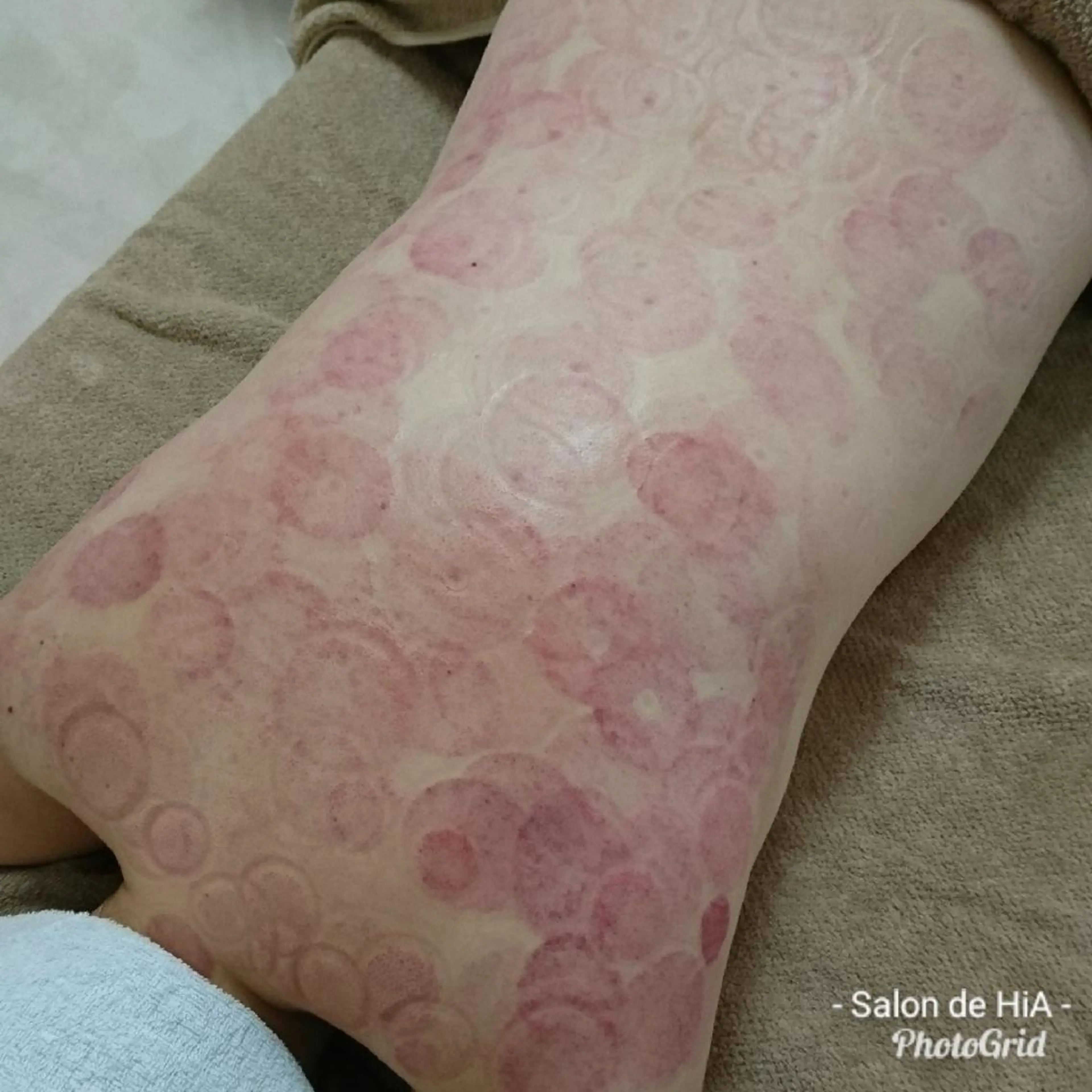 Salon de  HiAのエステ・リラクイメージ