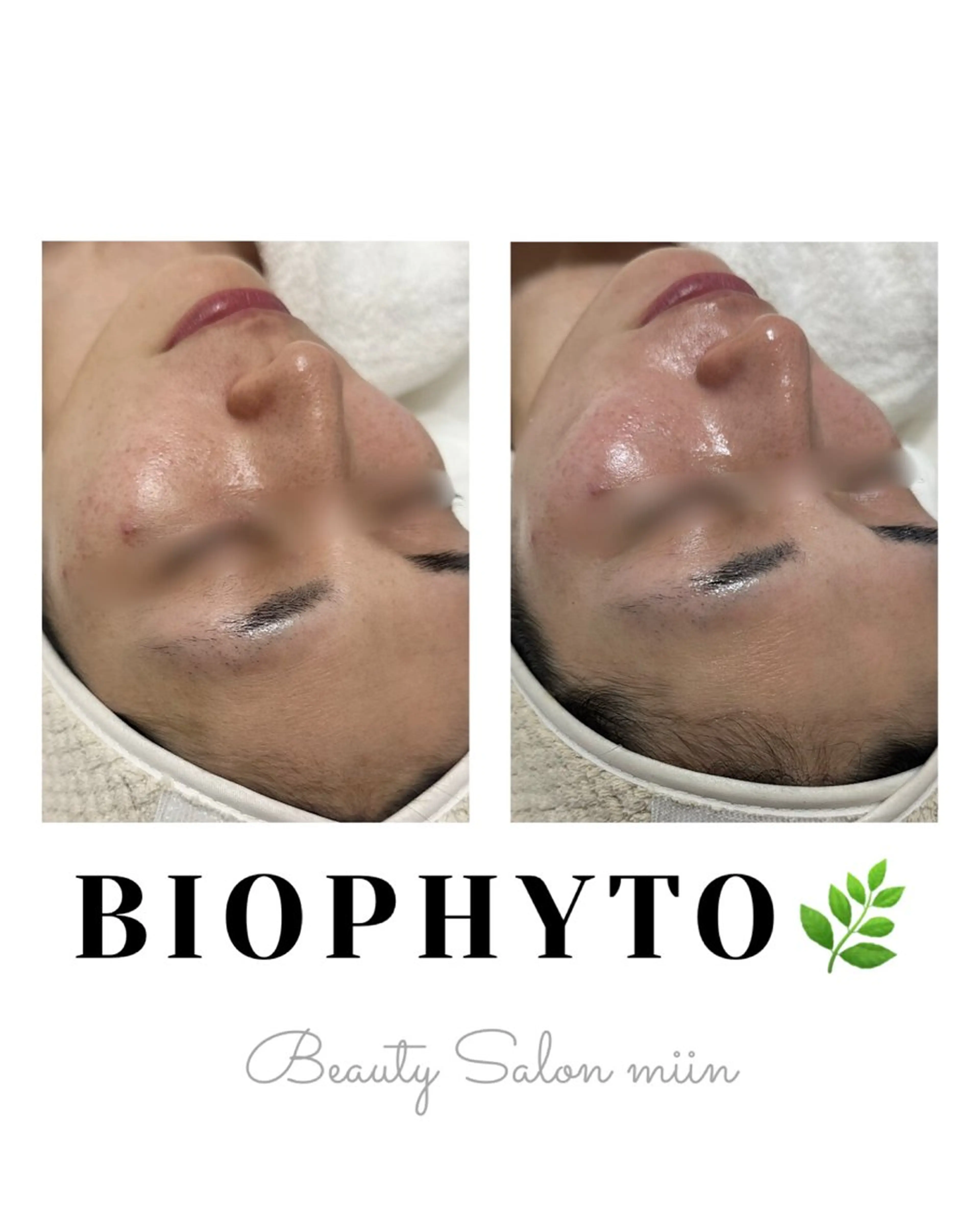 エステ 韓国肌管理 白玉肌管理®︎のエステ・リラクイメージ