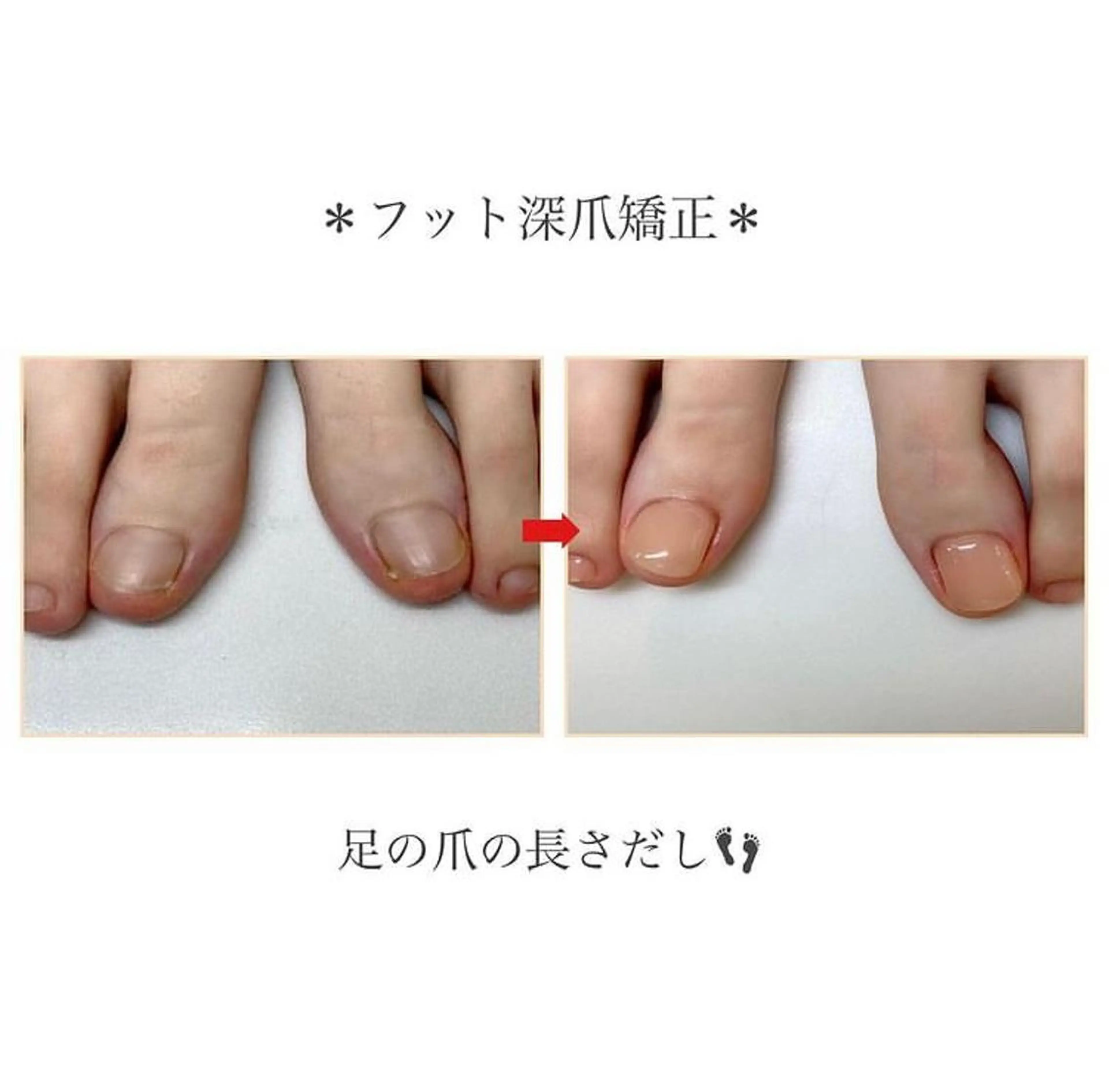 ネイル フットネイル ネイルサロンアリューム所属・ネイルサロン アリュームのネイルデザイン