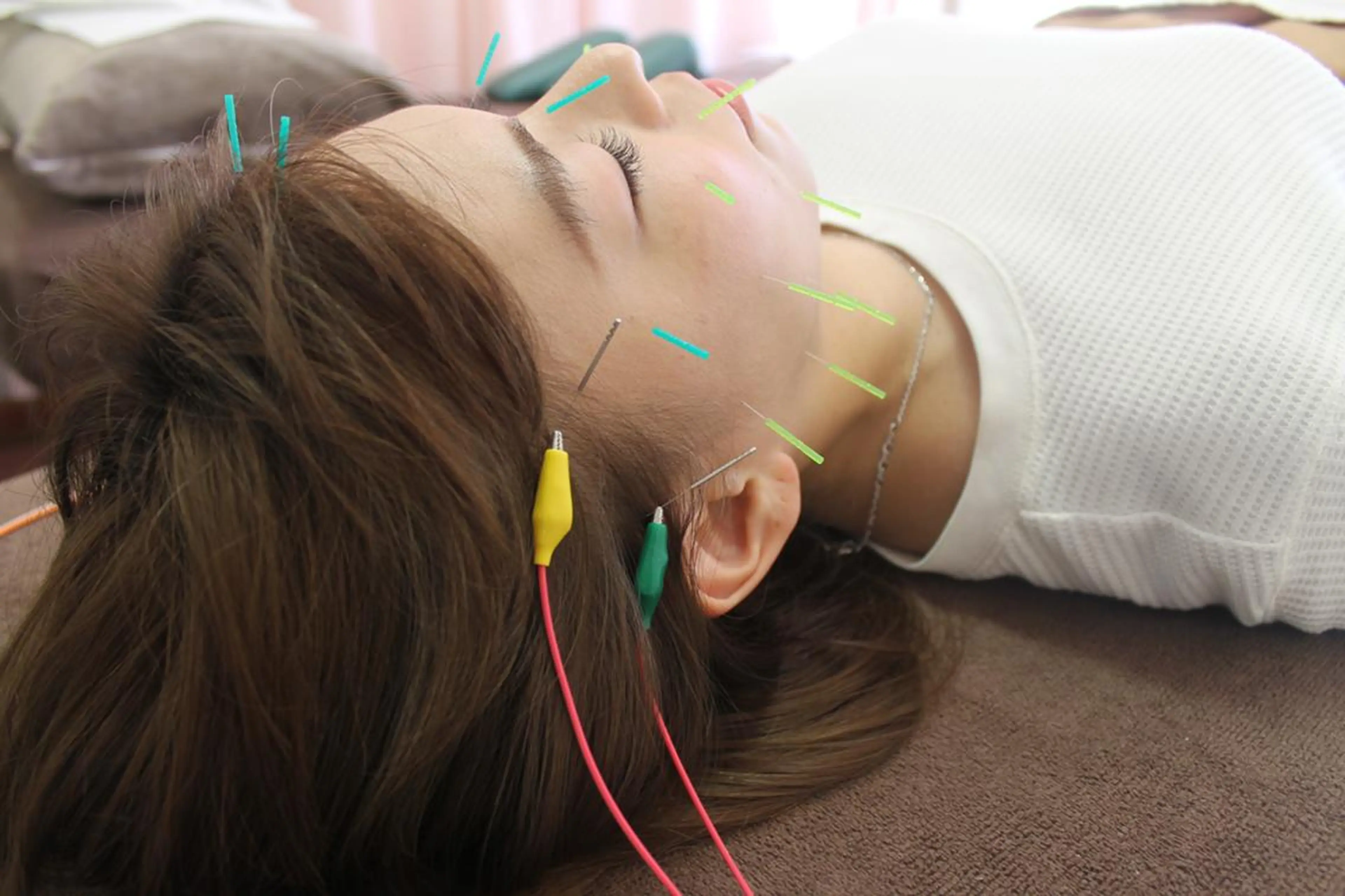 エステ リラク 同心整骨院 美容鍼・整体・小顔のエステ・リラクイメージ