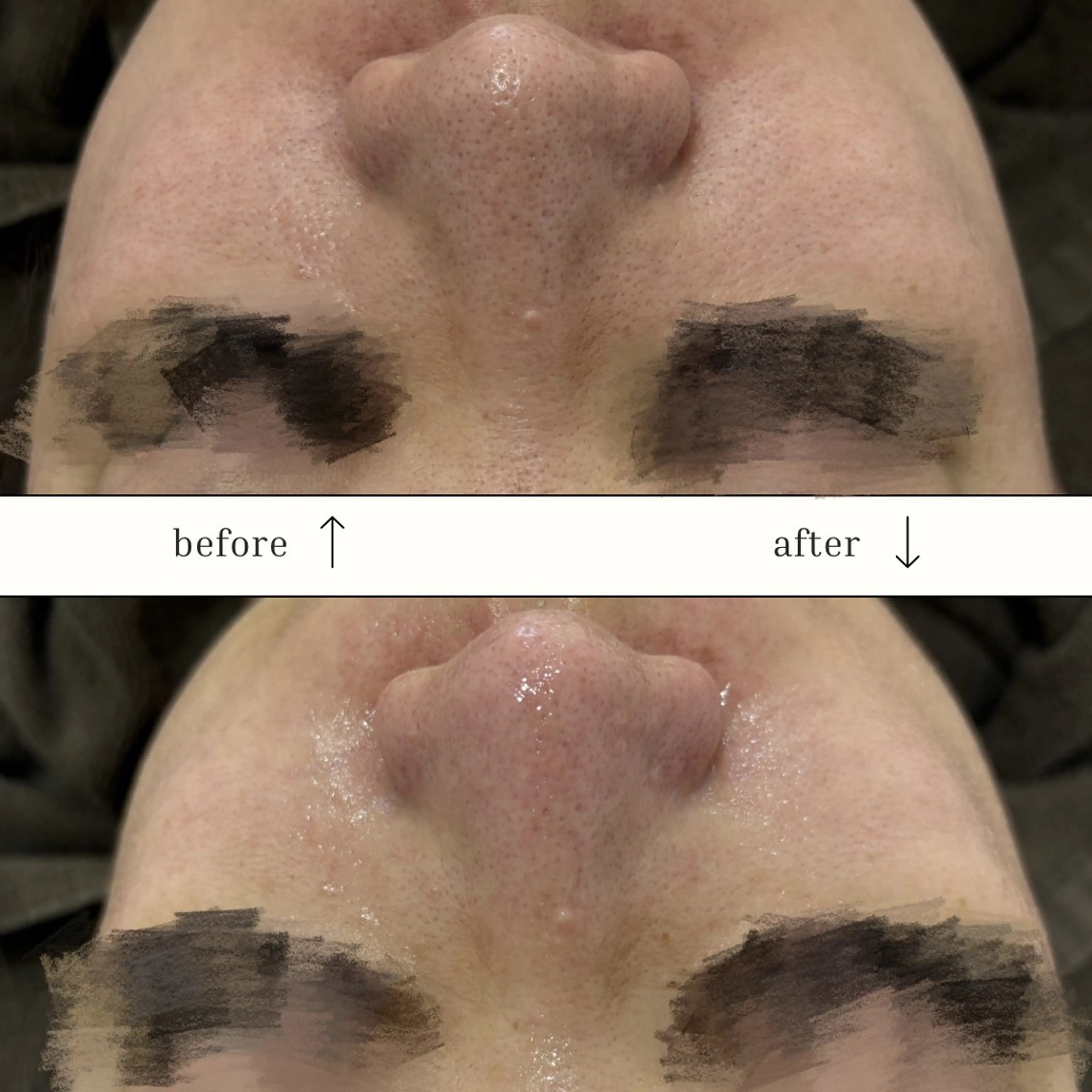 エステ 倉敷/玉島/20代 からの大人毛穴洗浄のエステ・リラクイメージ