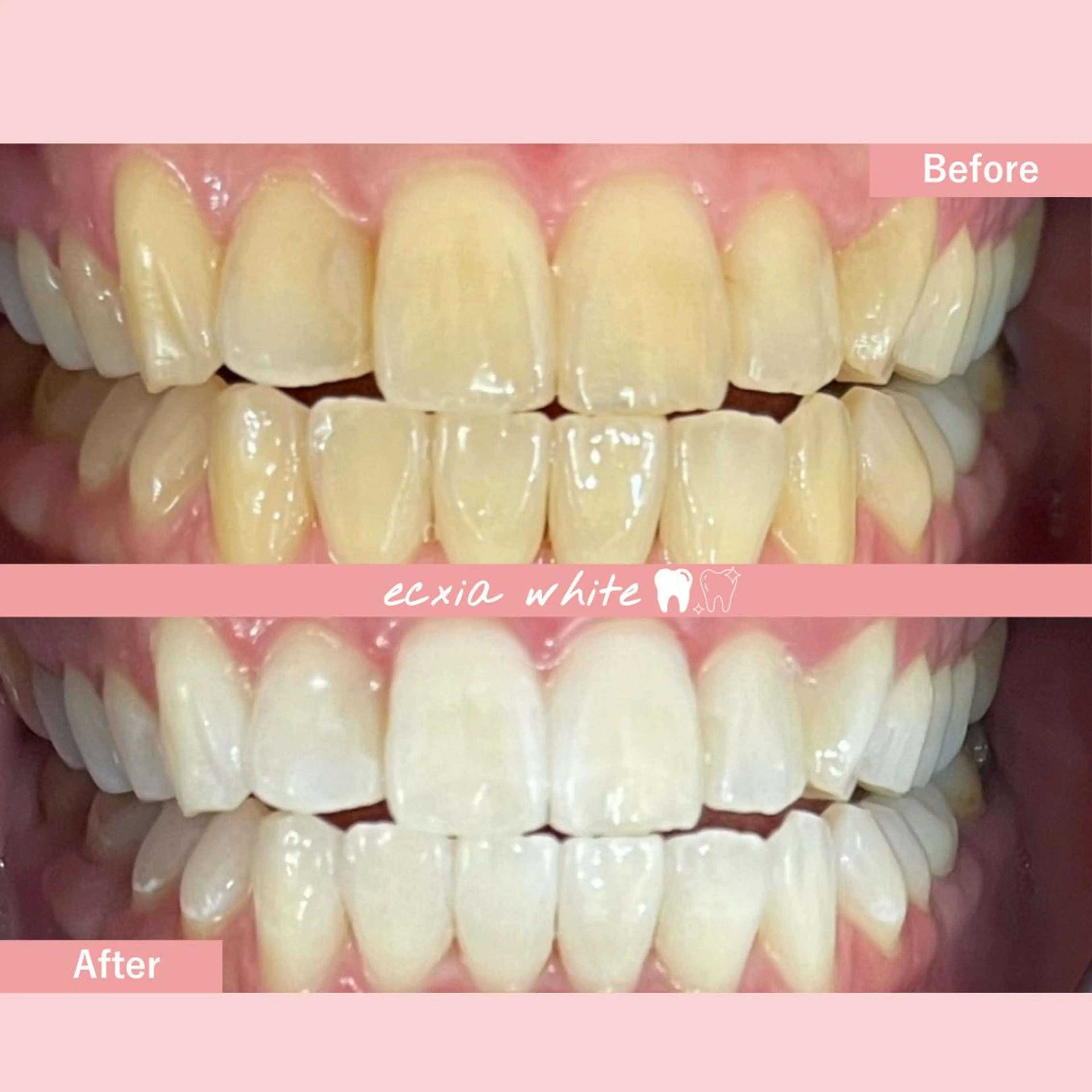 セルフホワイトニング エクシア中島公園店のその他イメージ