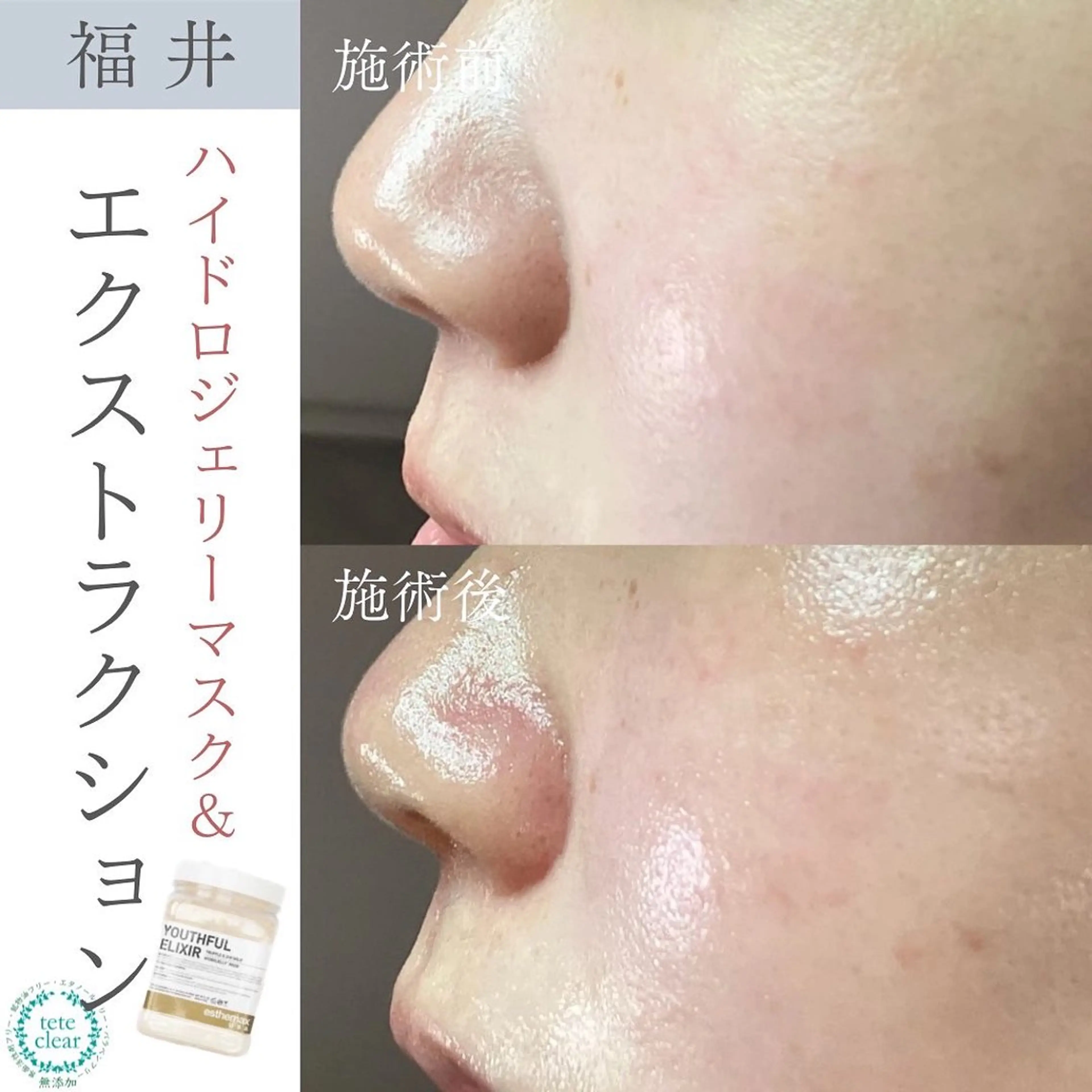毛穴肌質ケアサロン Yourmeユアミーのエステ・リラクイメージ