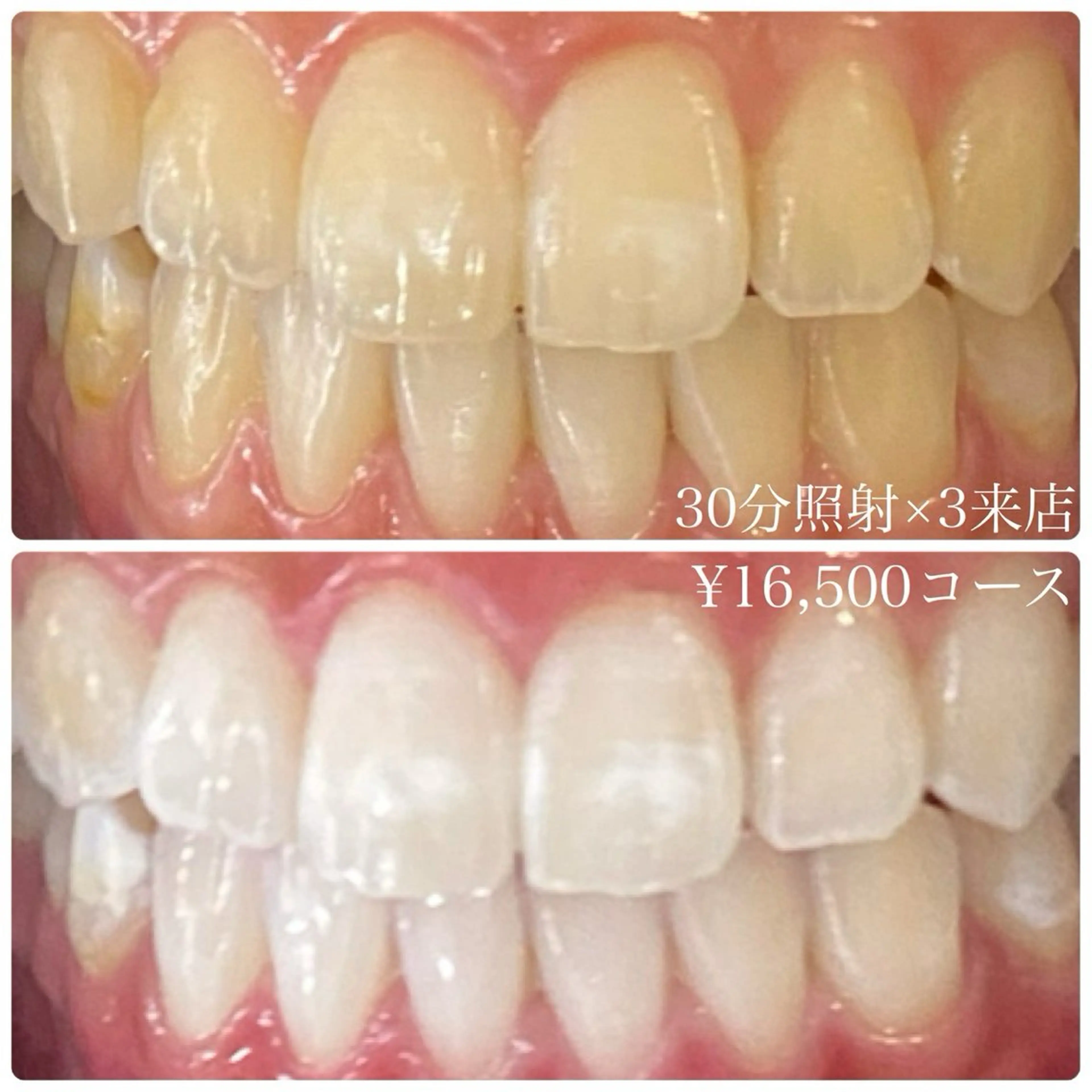 その他 PLATINUM Beauty 横浜店所属・ホワイトニングルーム 横浜店のその他イメージ