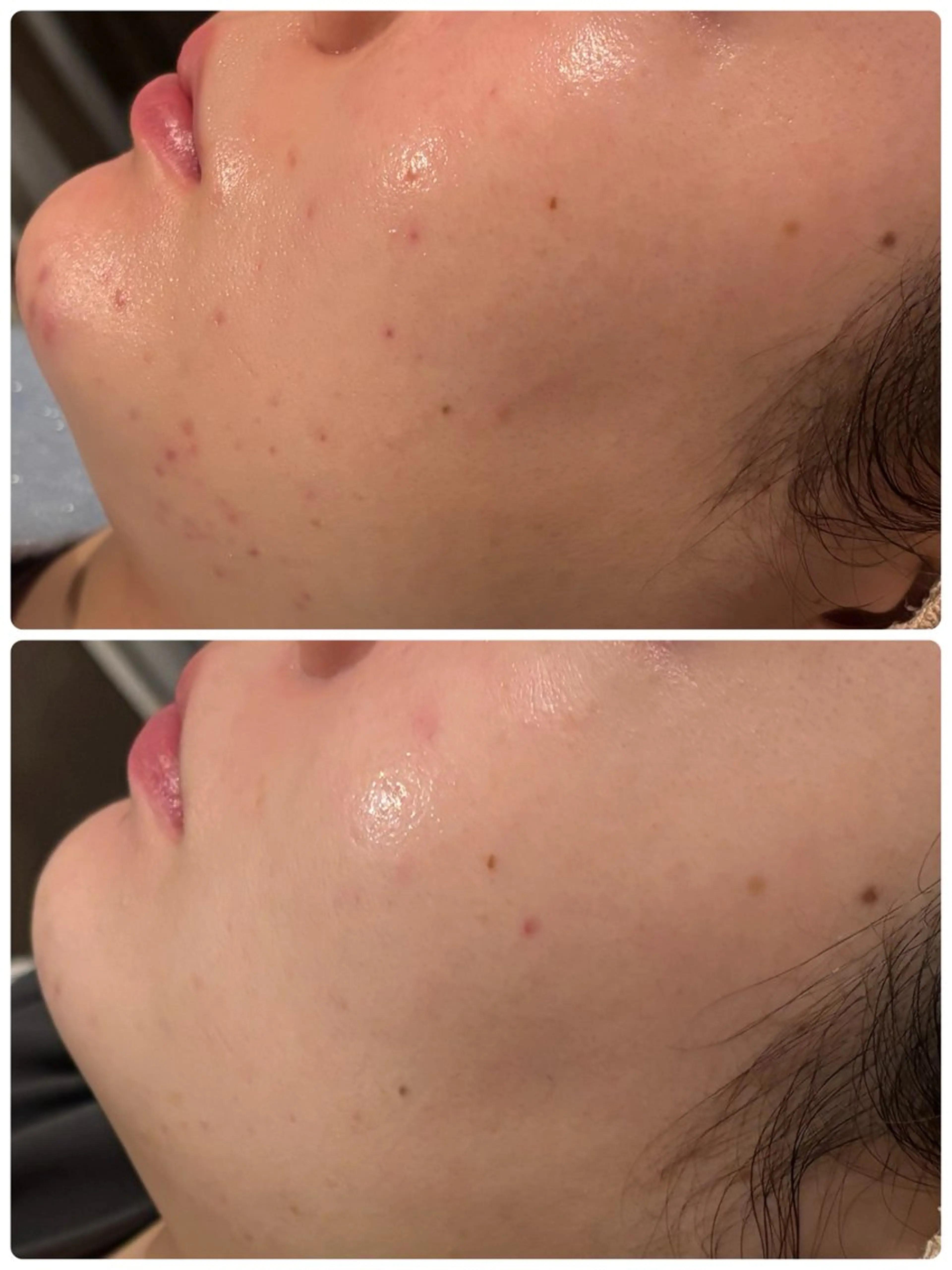 エステ 【リベルハーブピーリング認定店】敏感肌・美白脱毛専門店Dione立川店所属・Dione 立川店のエステ・リラクイメージ