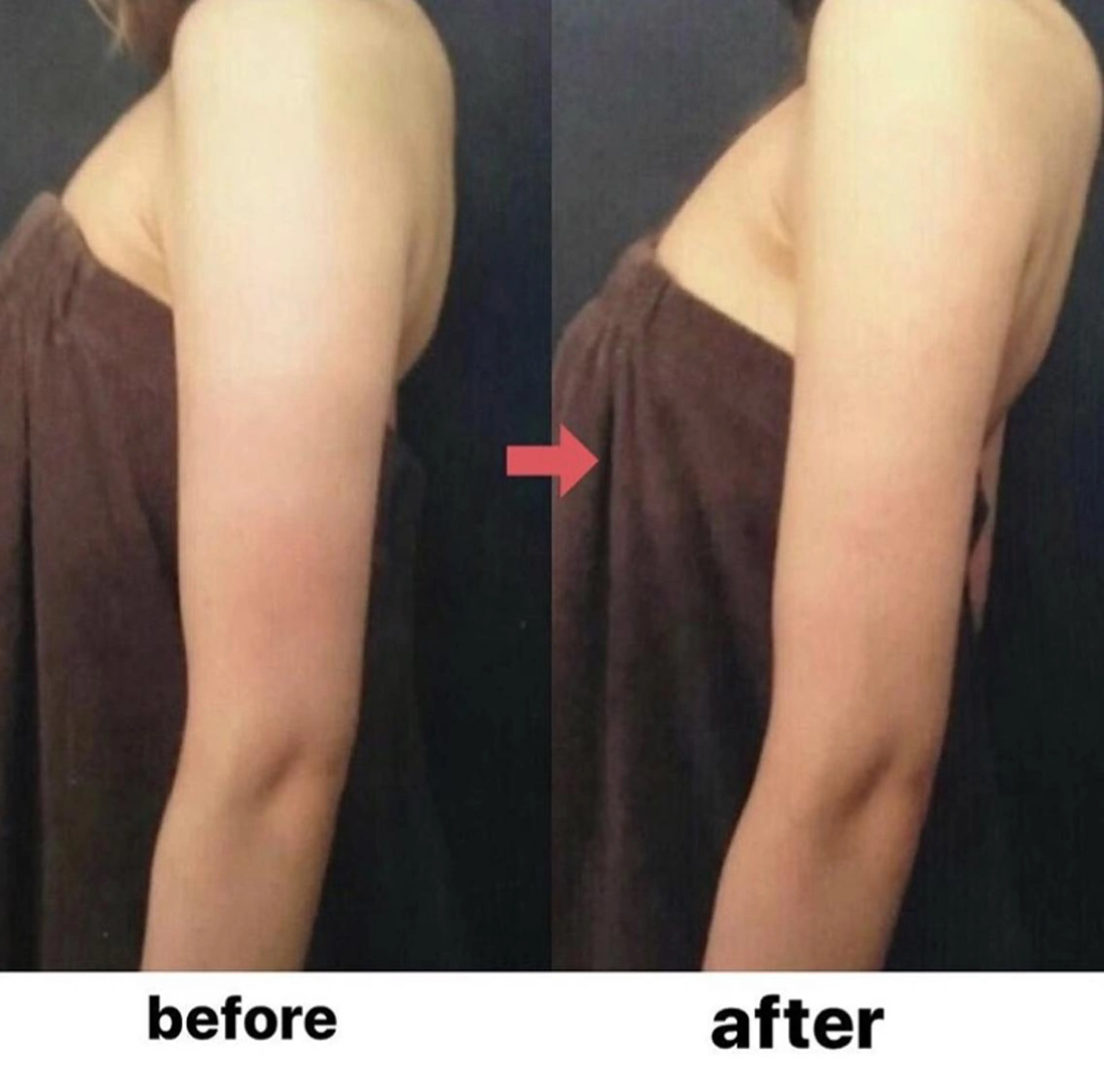 横浜エステサロン R-ing リングのエステ・リラクイメージ