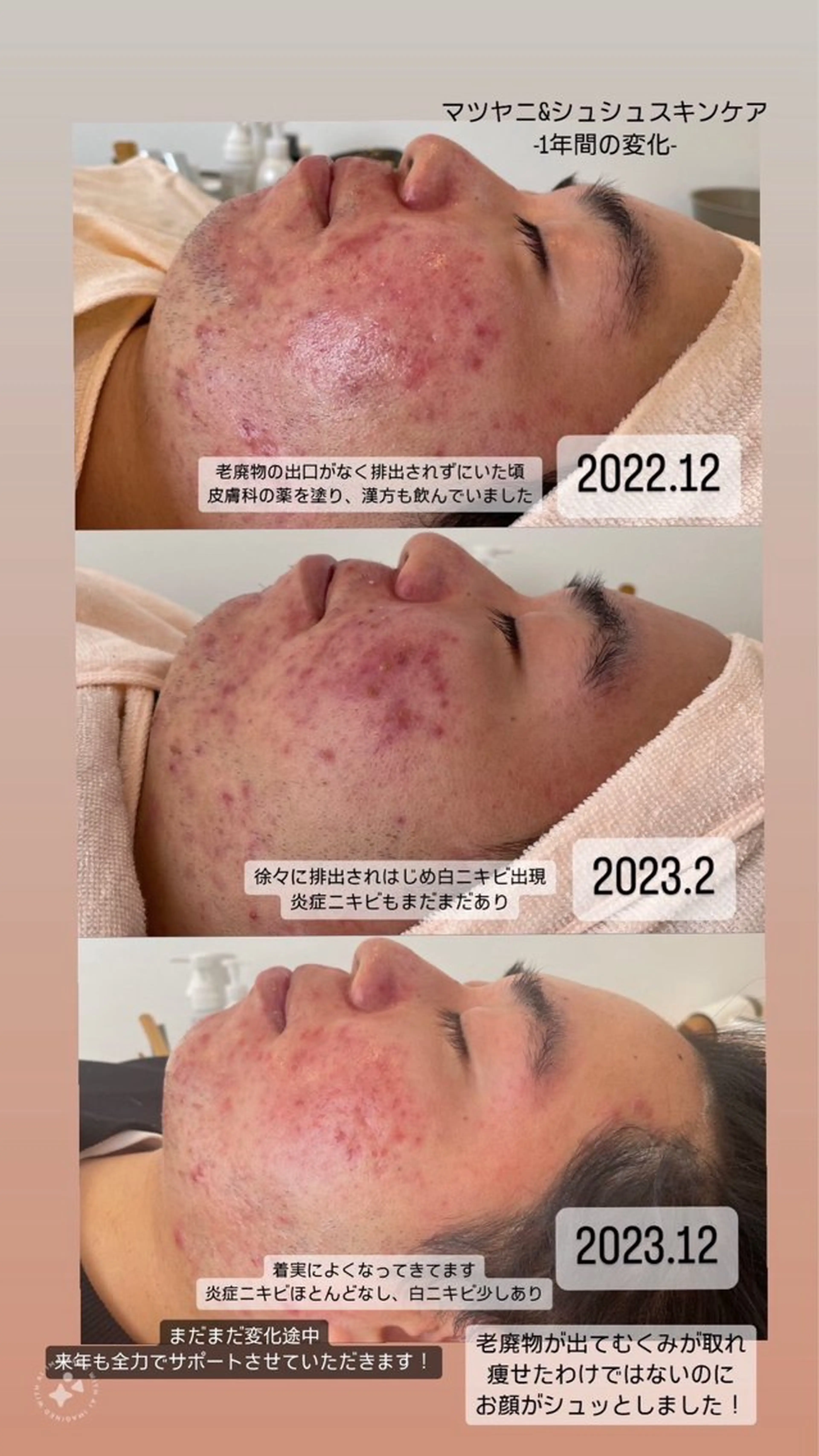 ヌーベル プリュムのその他イメージ