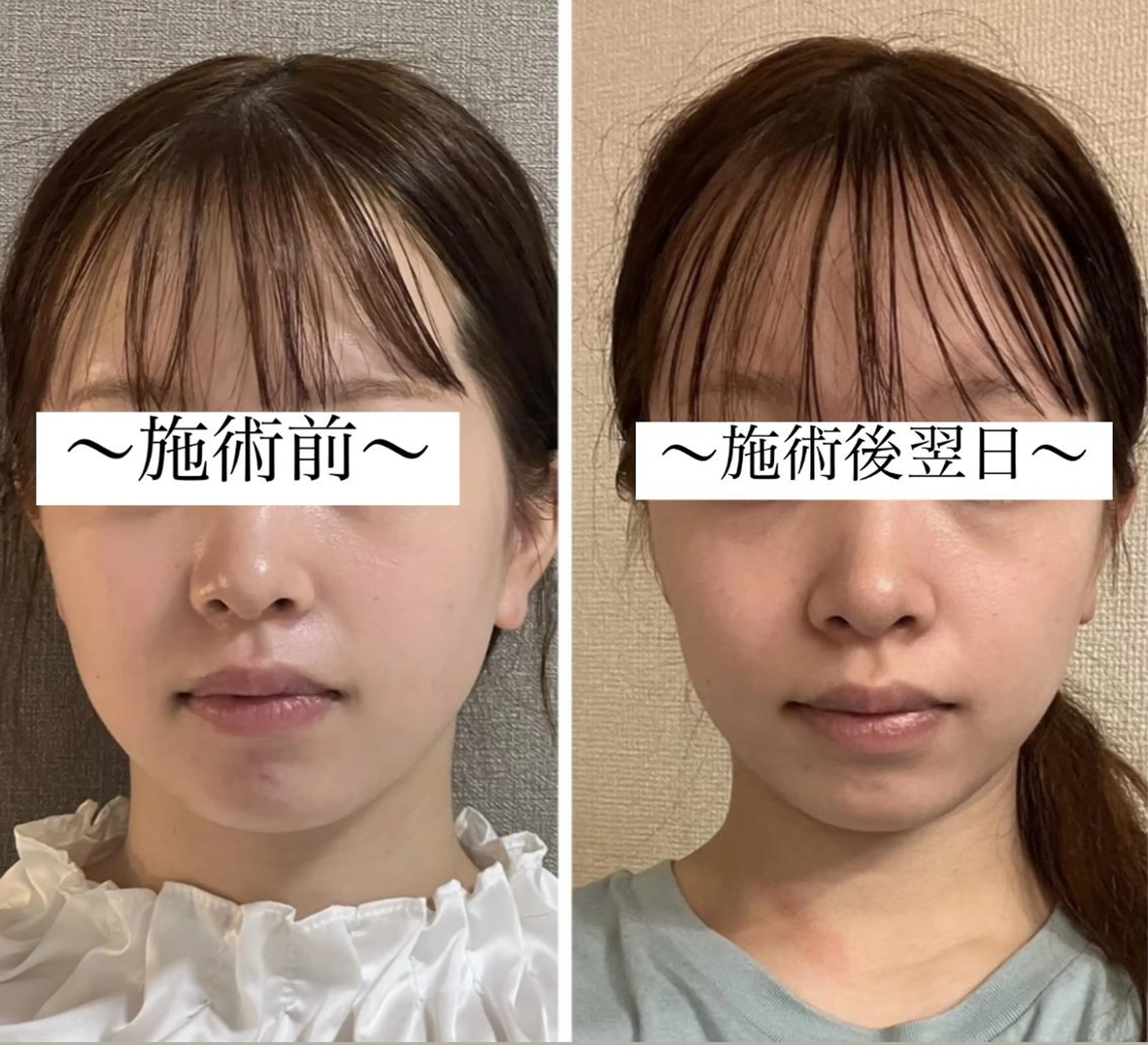 EMINY （エステティシャン）のエステ・リラクイメージ