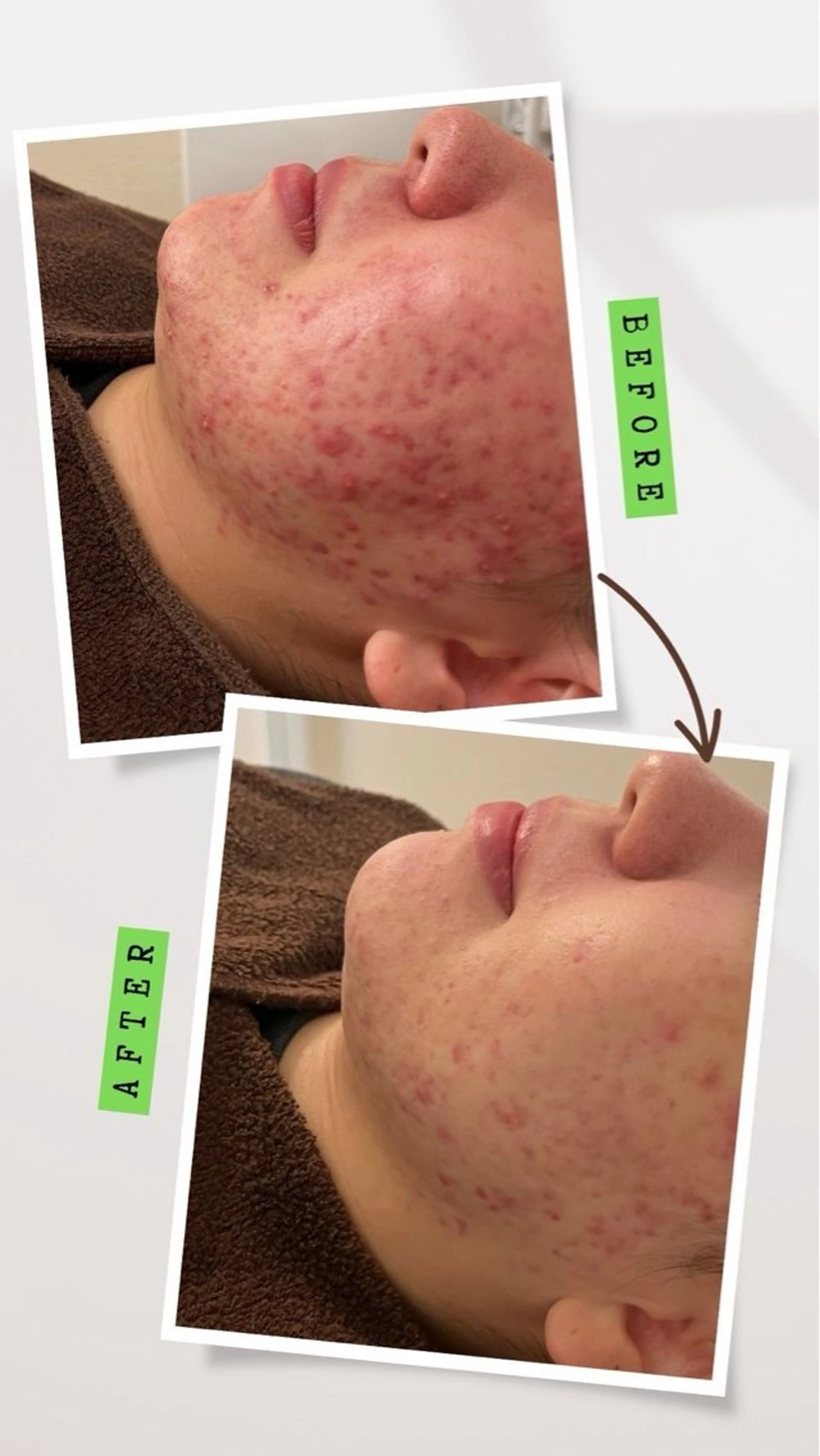 エステ ANERA Second所属・尾上 沙織のエステ・リラクイメージ