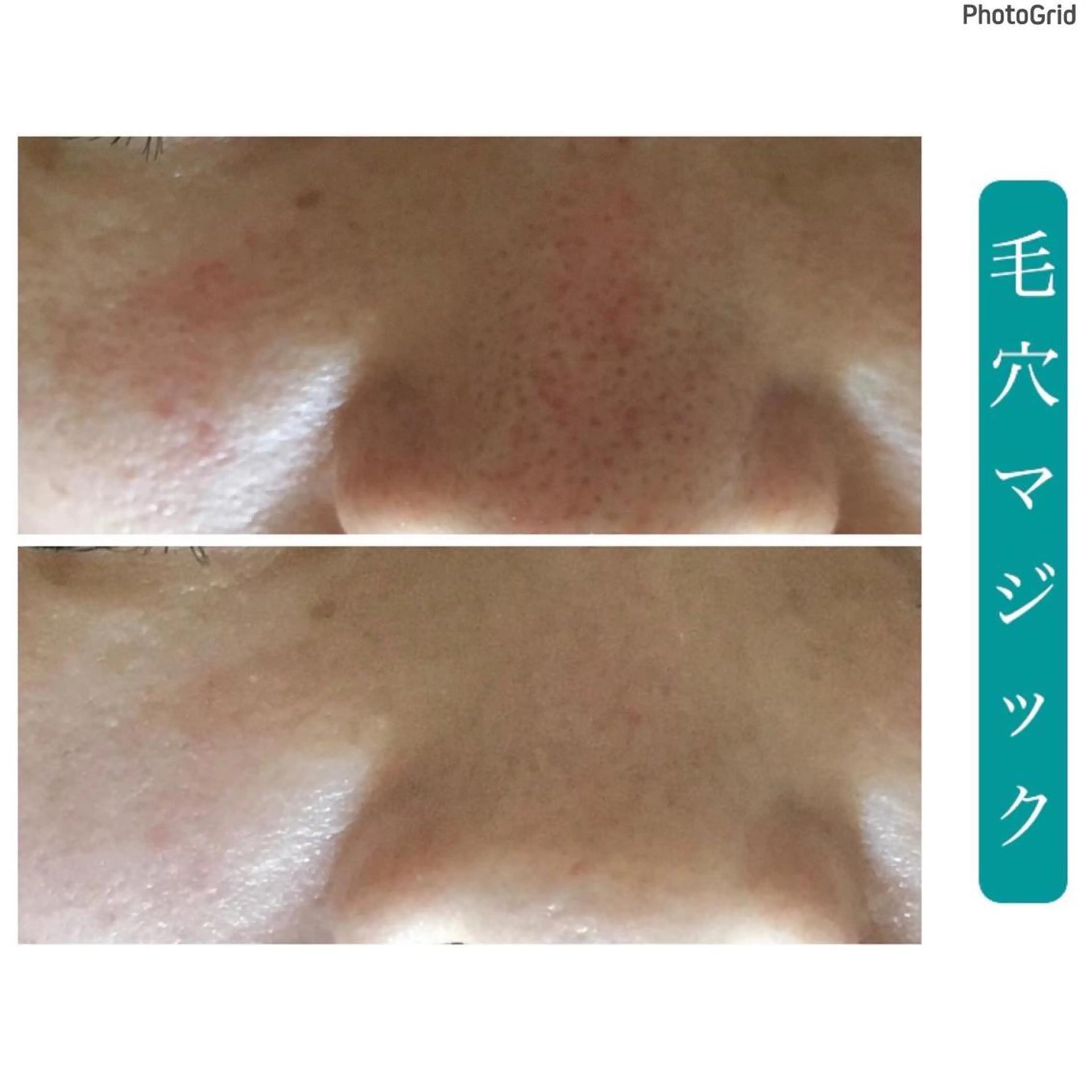 艶肌&小顔リフト❤︎ プチアンジェ茅ヶ崎のエステ・リラクイメージ