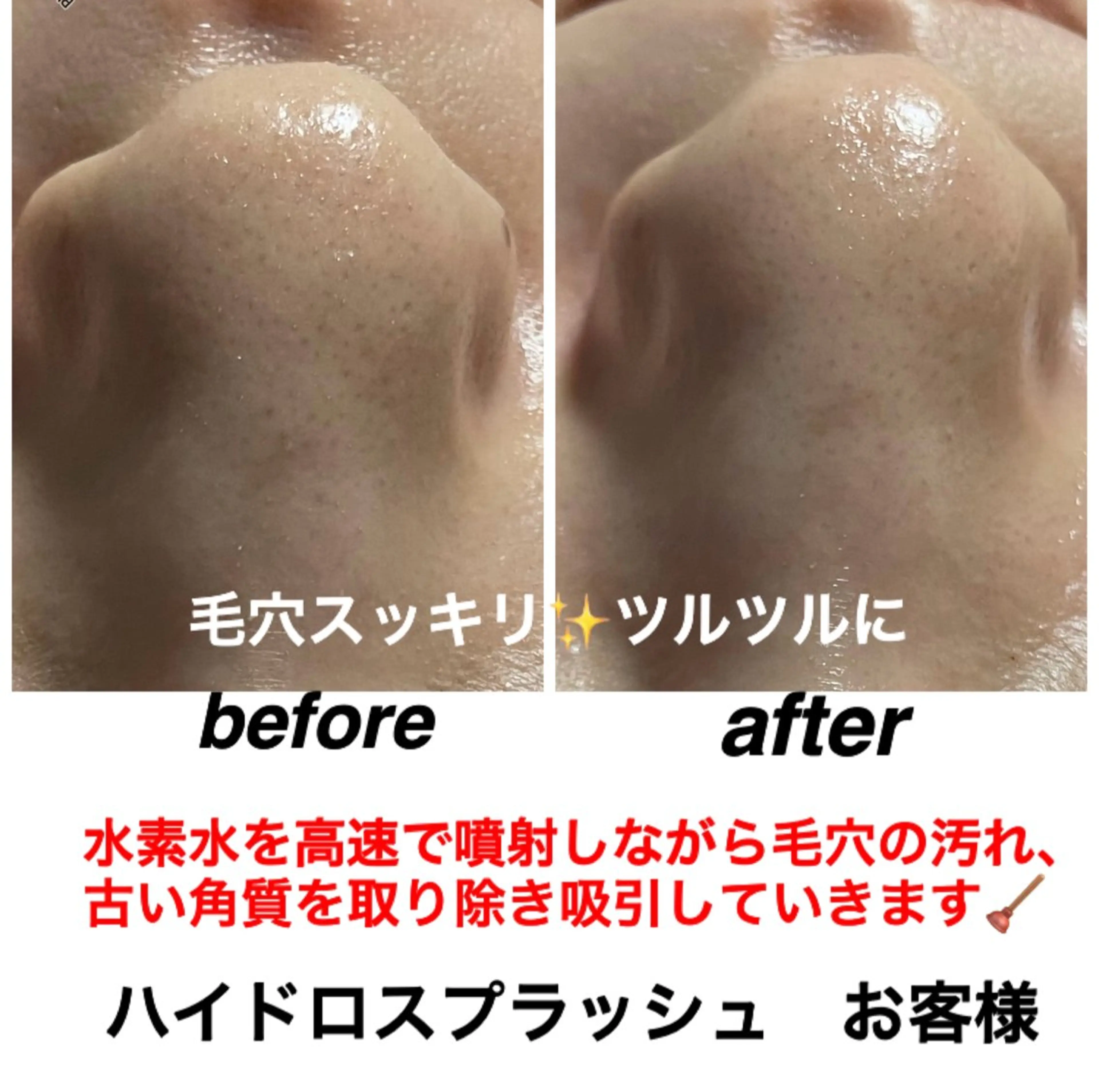 エステ リラク ネイル・エステサロン UILANIのネイルデザイン