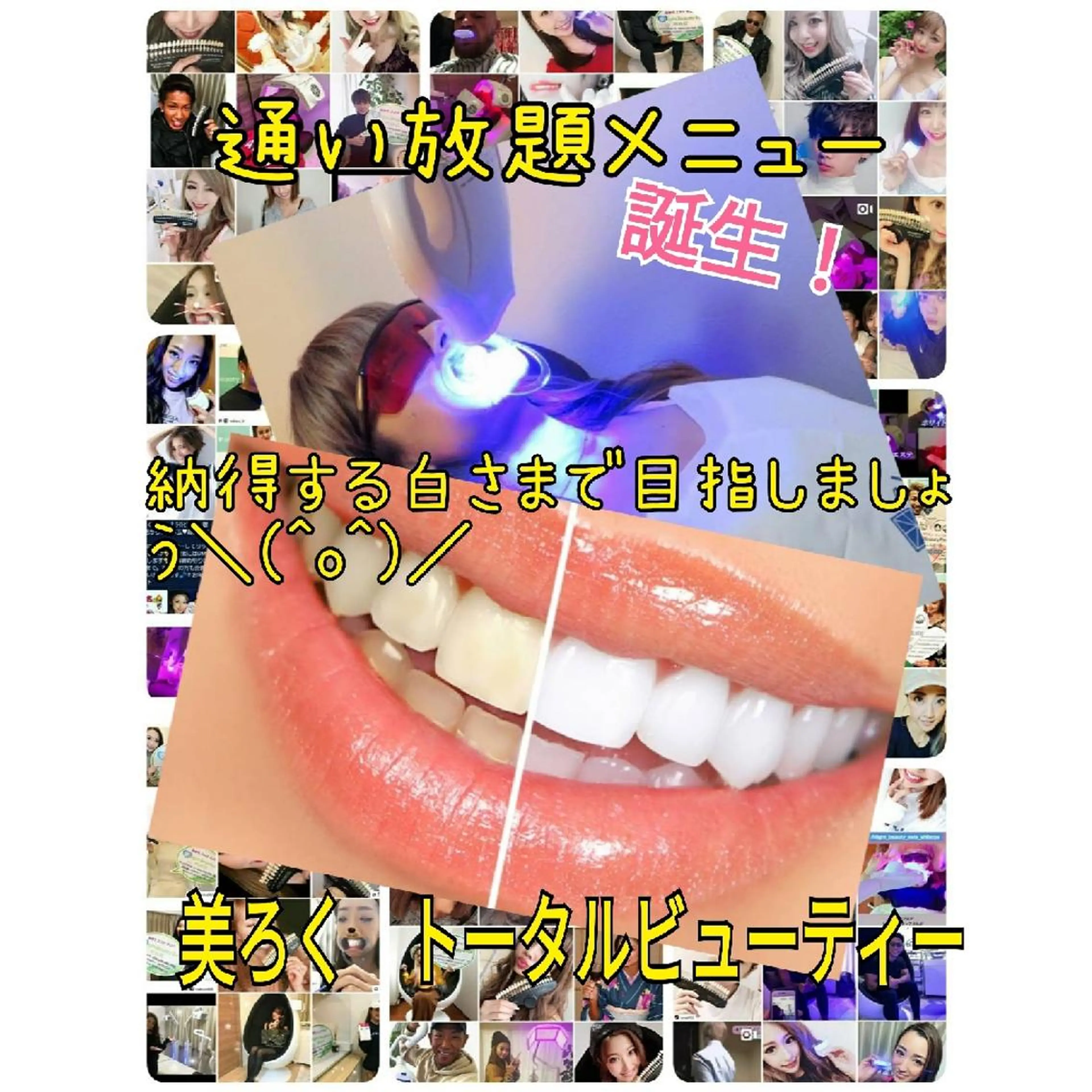 【通い放題年間継続プラン✨】♔納得する白さまで目指しましょう✨セルフホワイトニングし放題🦷　11000円/1ヶ月の写真