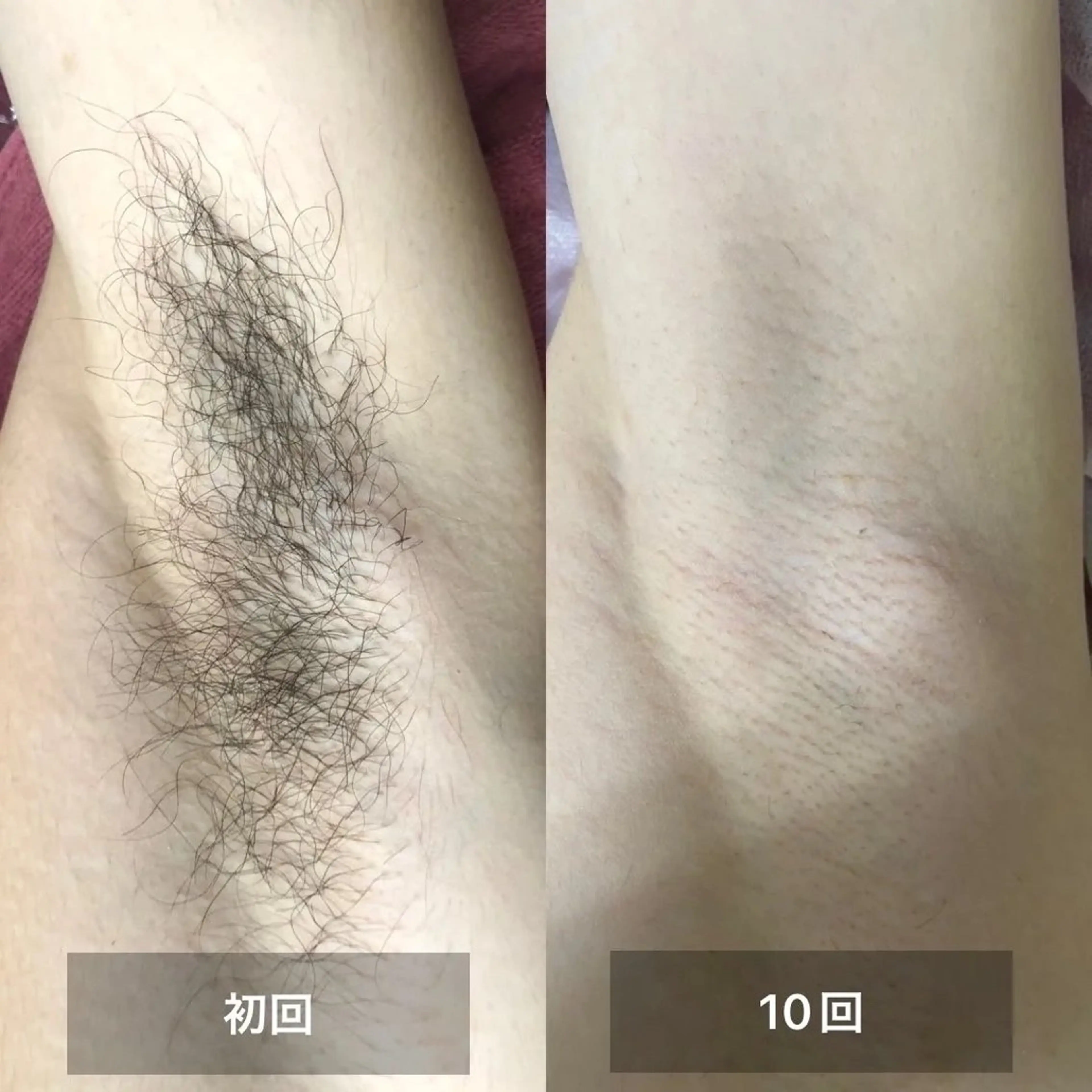 美肌，美ボディ，脱毛 サクラチャンスパのエステ・リラクイメージ